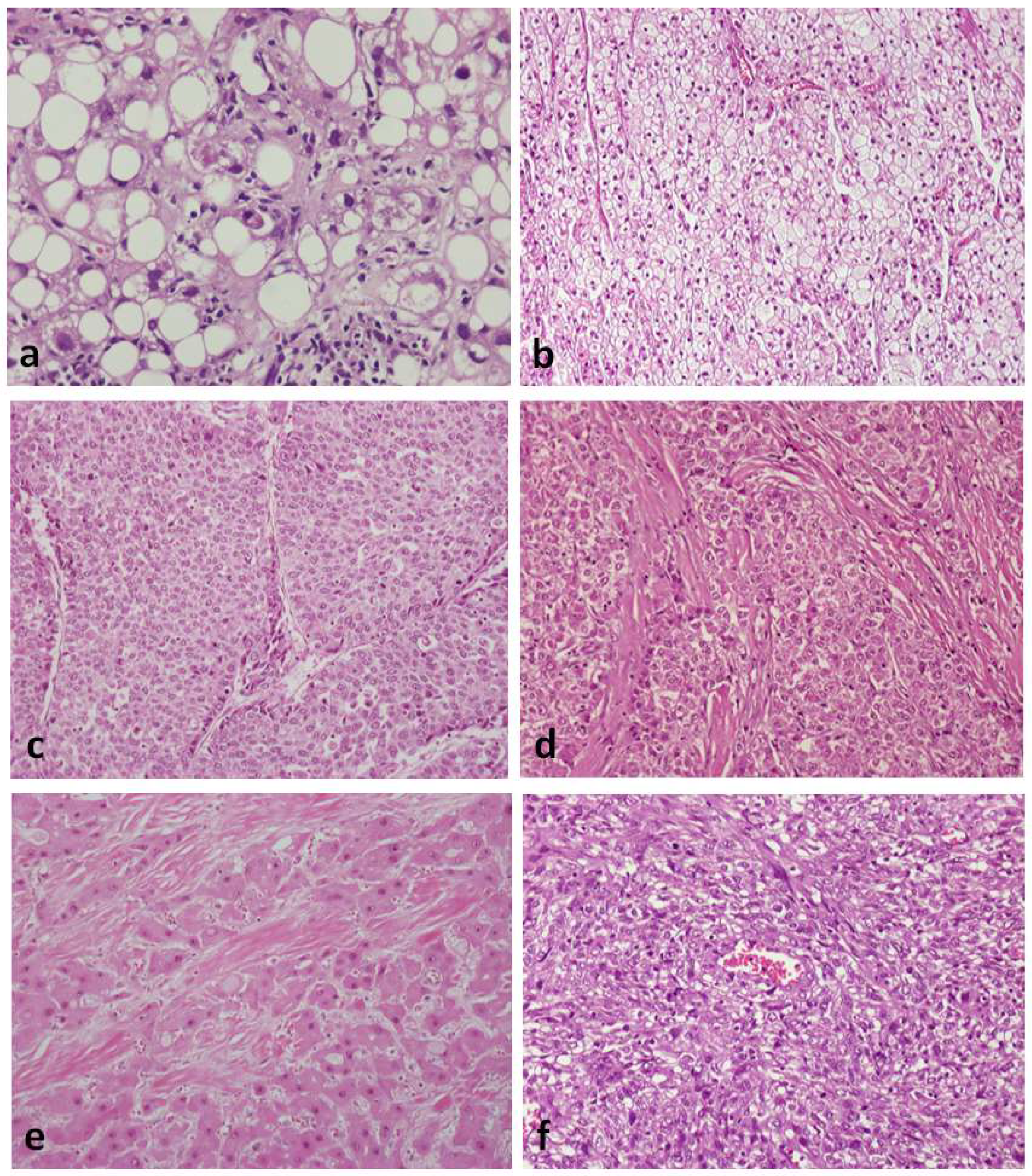 Cancers 14 03670 g005 550