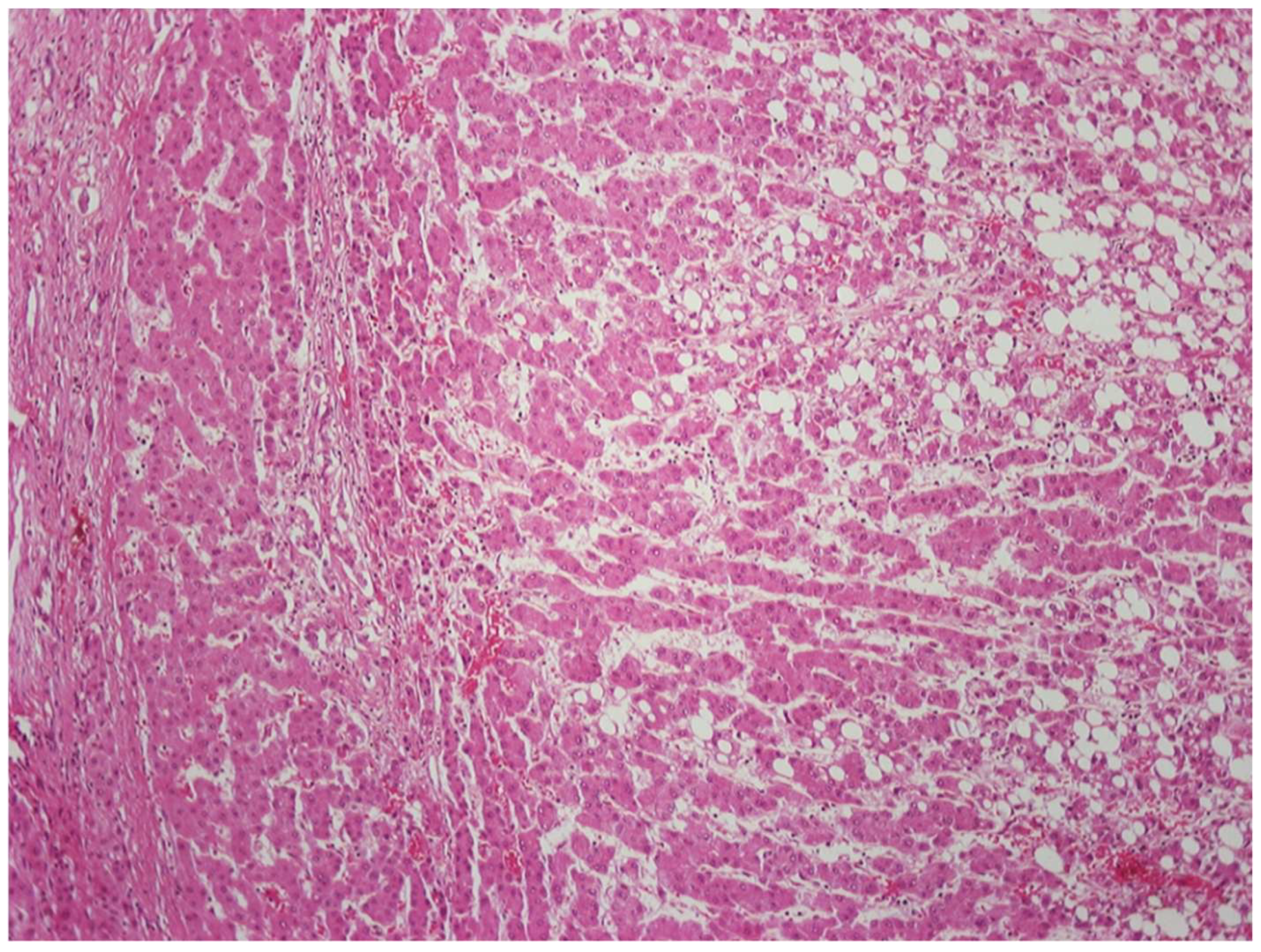 Cancers 14 03670 g006 550