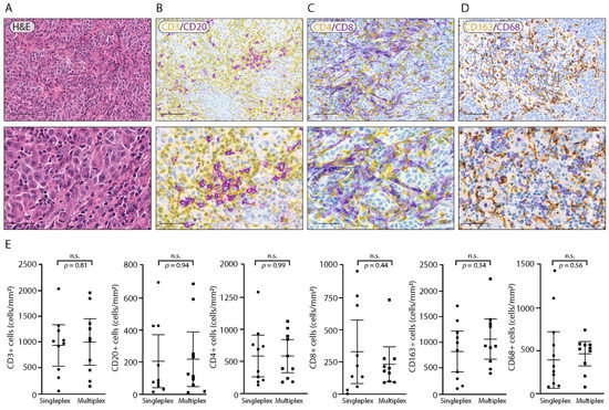 Bright-Field Multiplex Immunohistochemistry Assay for Tumor ...