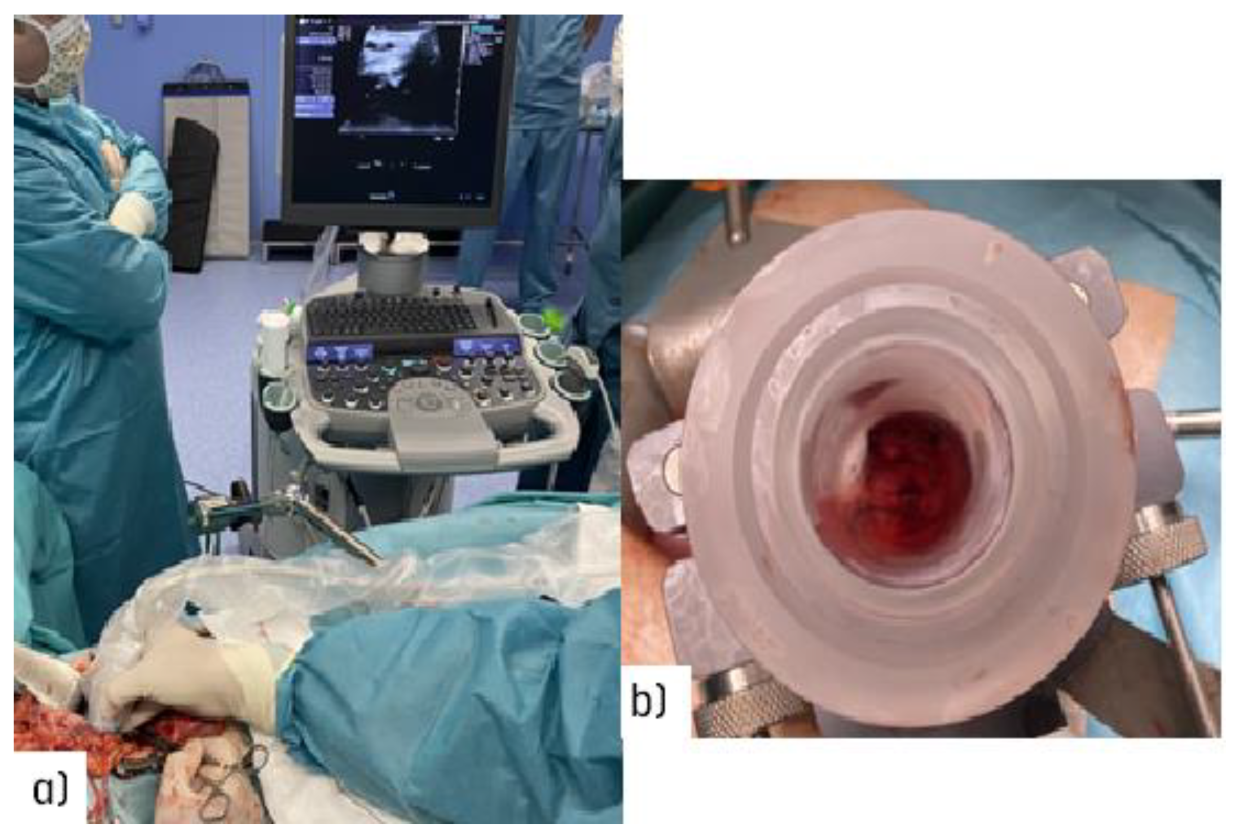 Cancers 14 03693 g002 Cancers 14 03693 g002