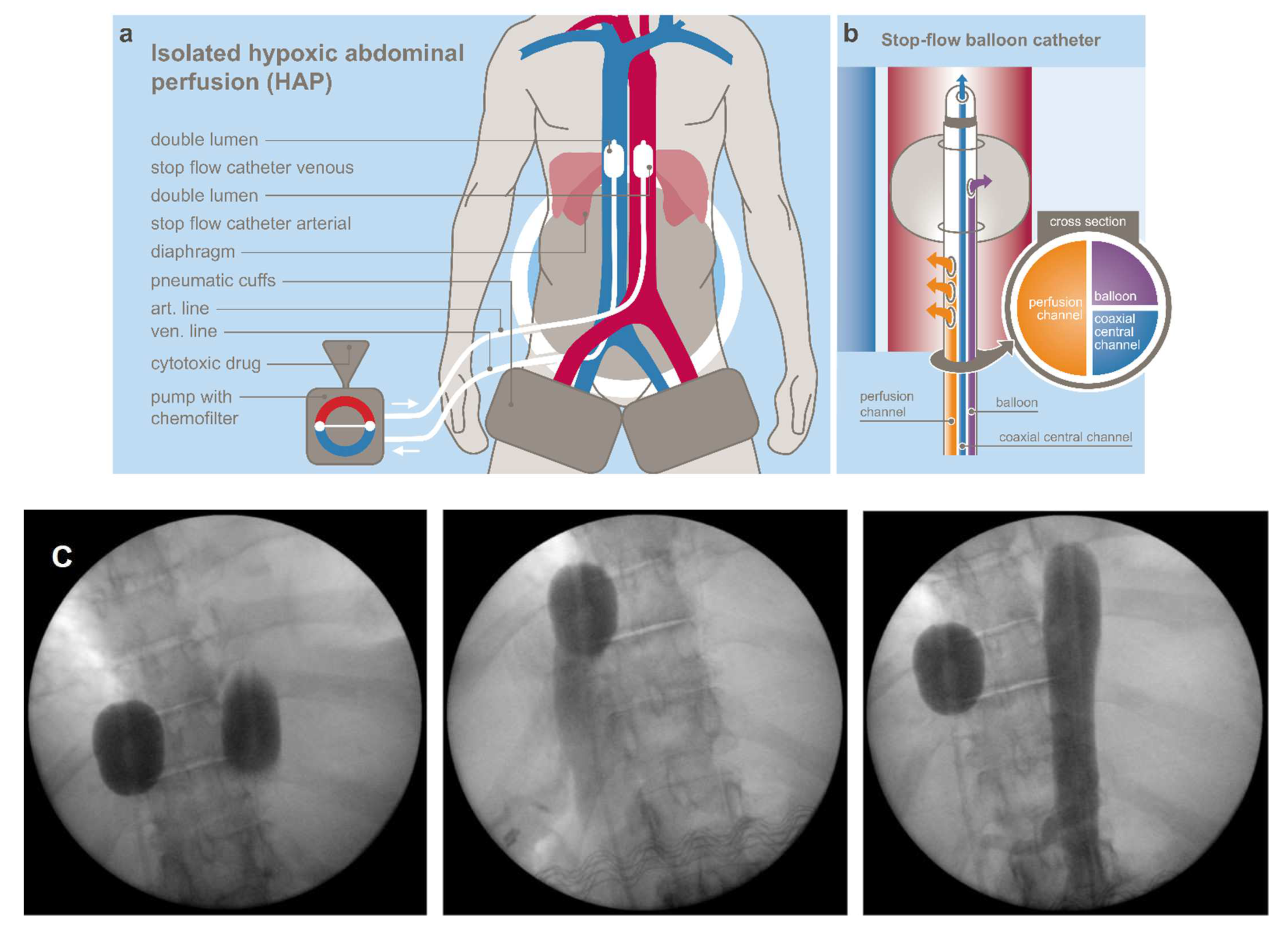 Cancers 14 03701 g001 Cancers 14 03701 g001