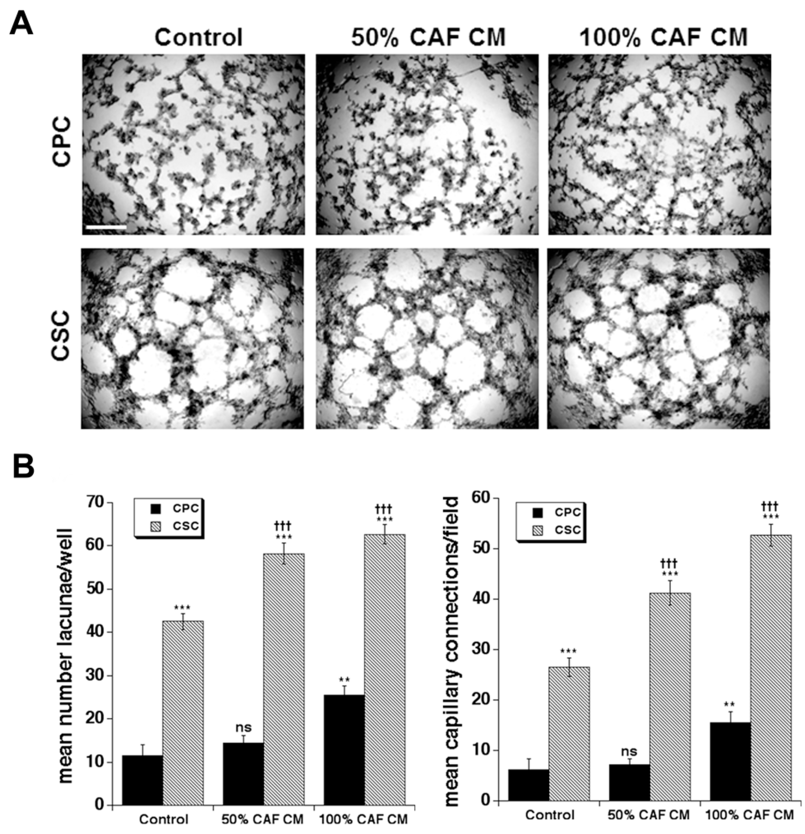 CAFC判例研究〈1〉 Cancer Associated Fibroblast (CAF) Regulation of PDAC
