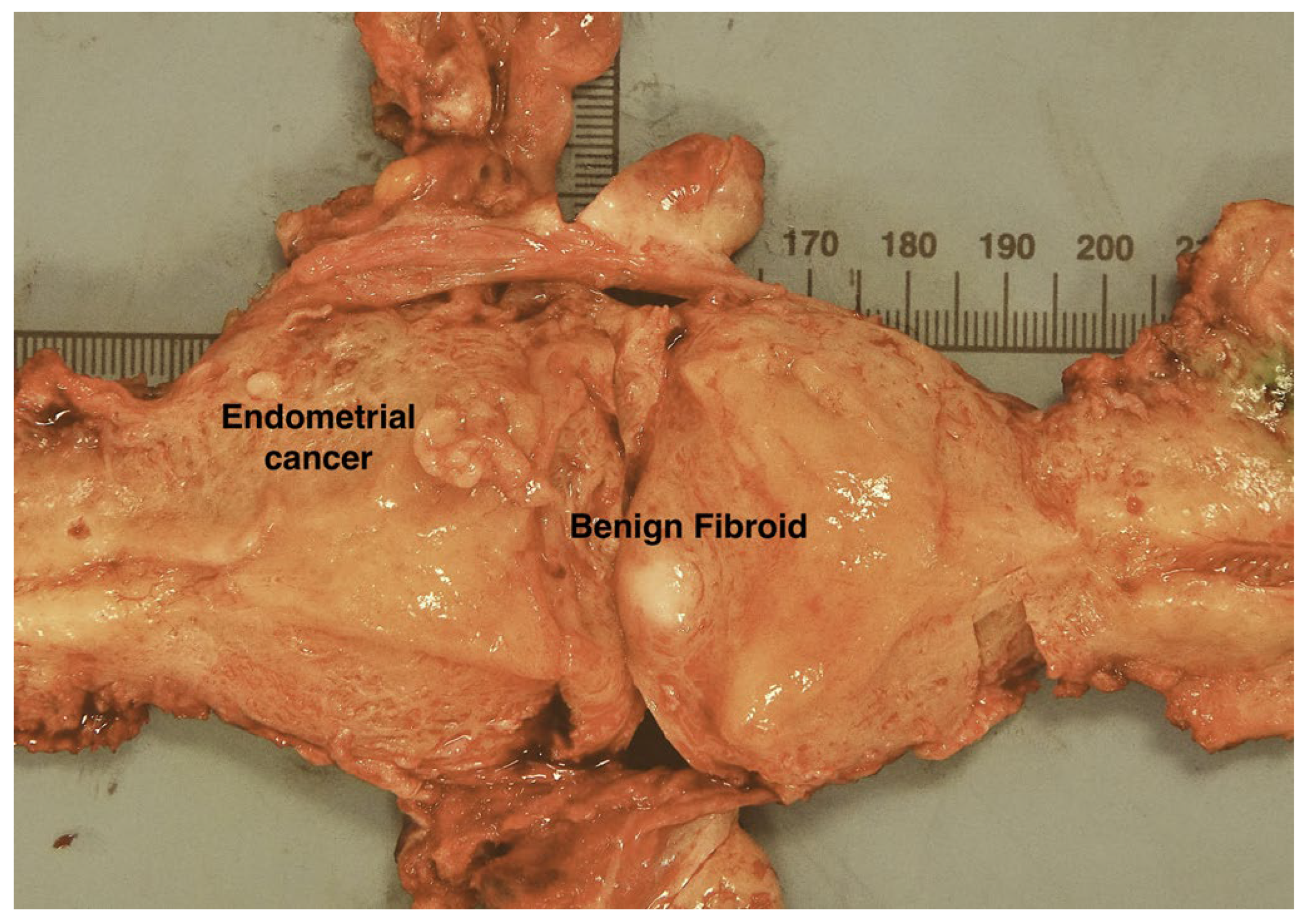 Cancers 14 03838 g006