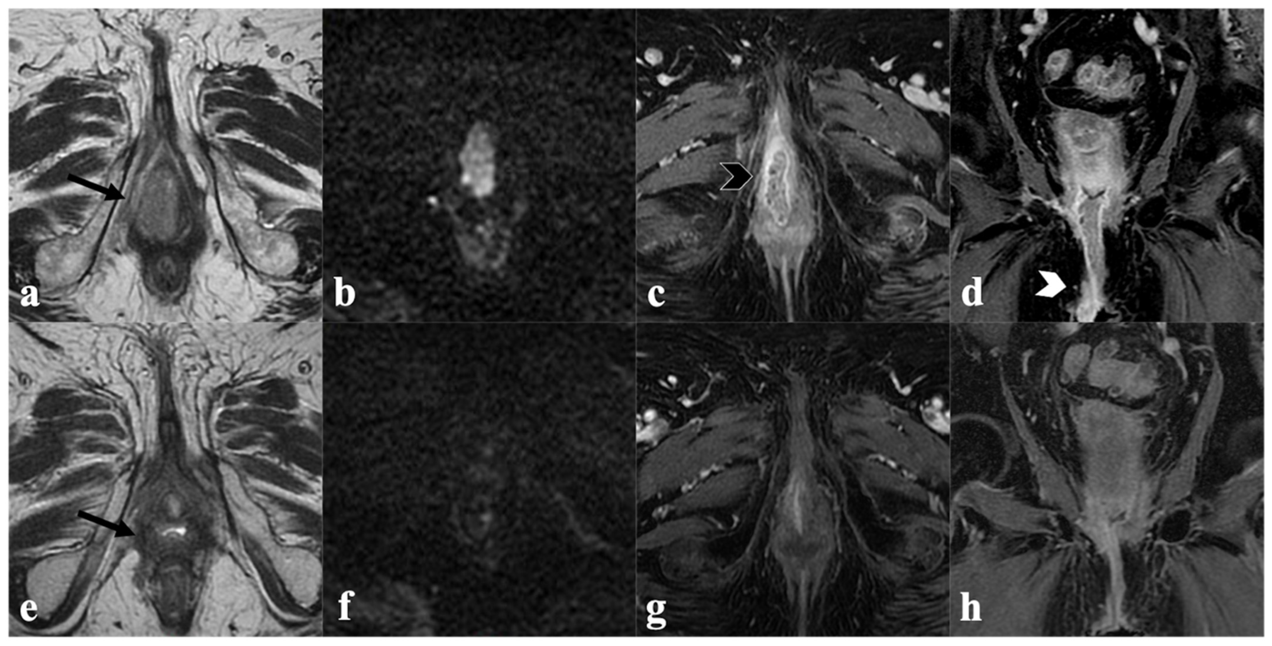 Cancers 14 03852 g002 Cancers 14 03852 g002