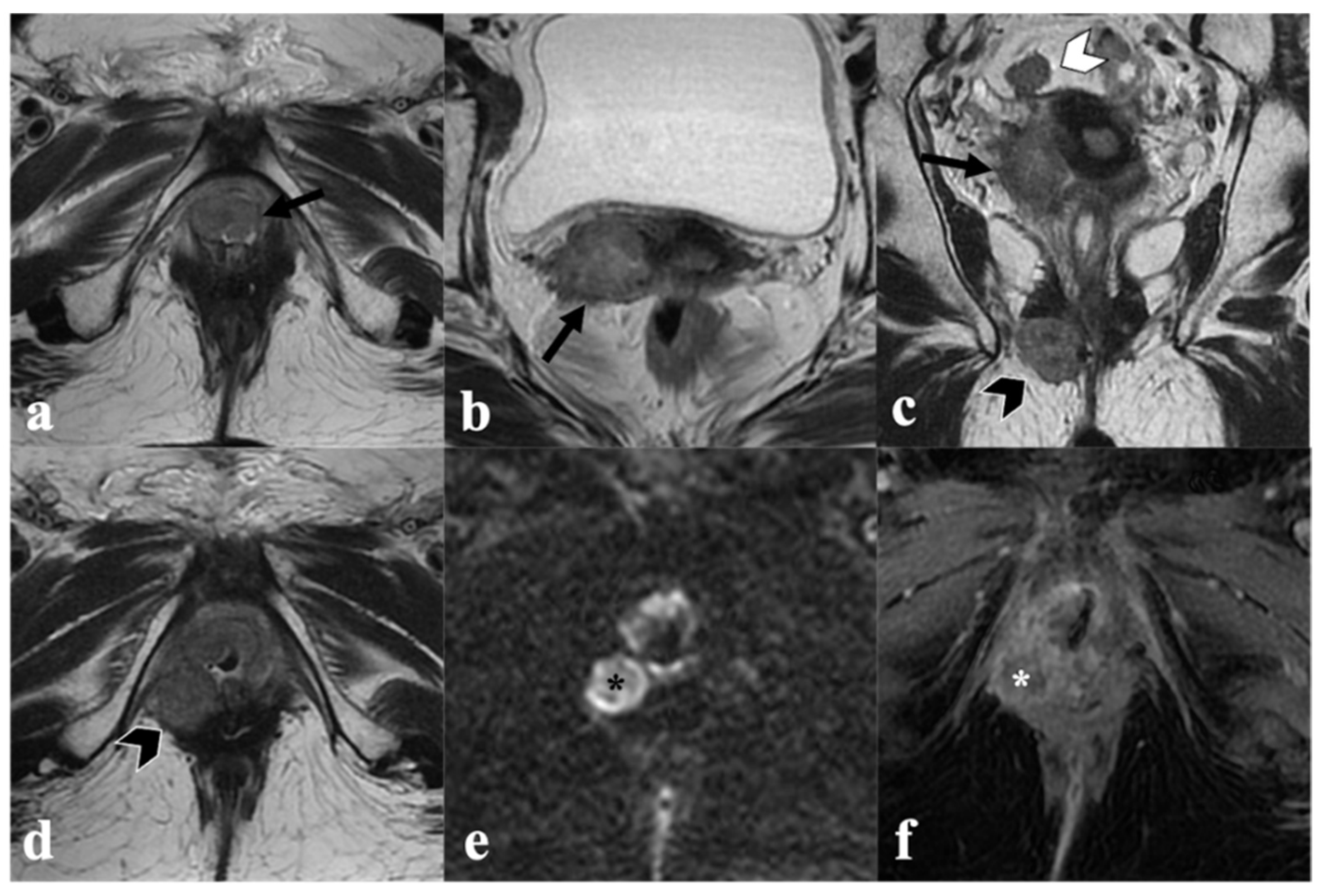 Cancers 14 03852 g006 Cancers 14 03852 g006