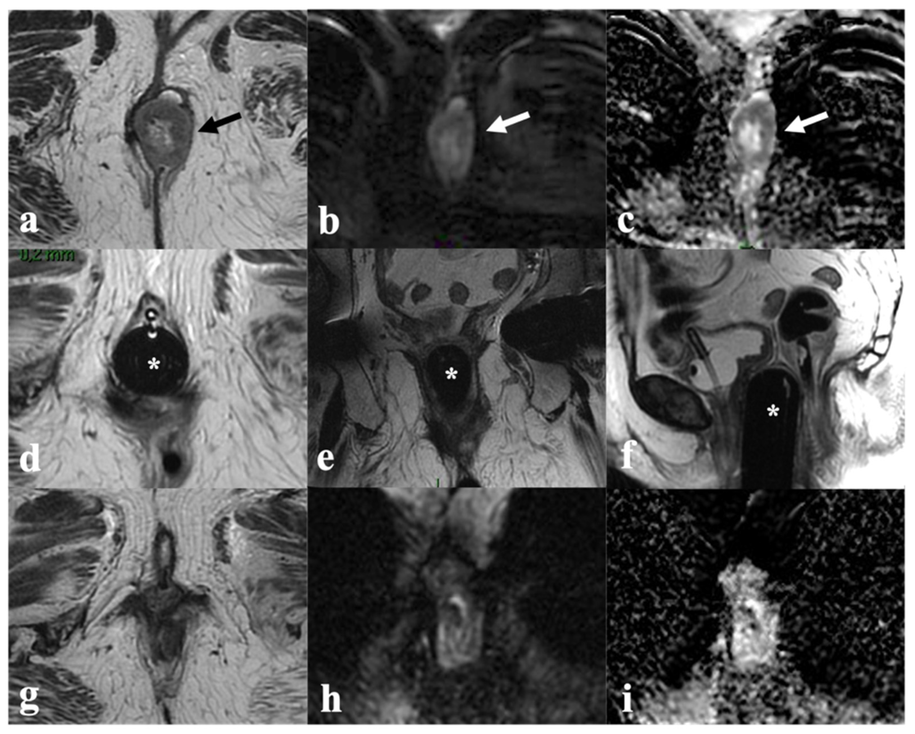 Cancers 14 03852 g007 Cancers 14 03852 g007