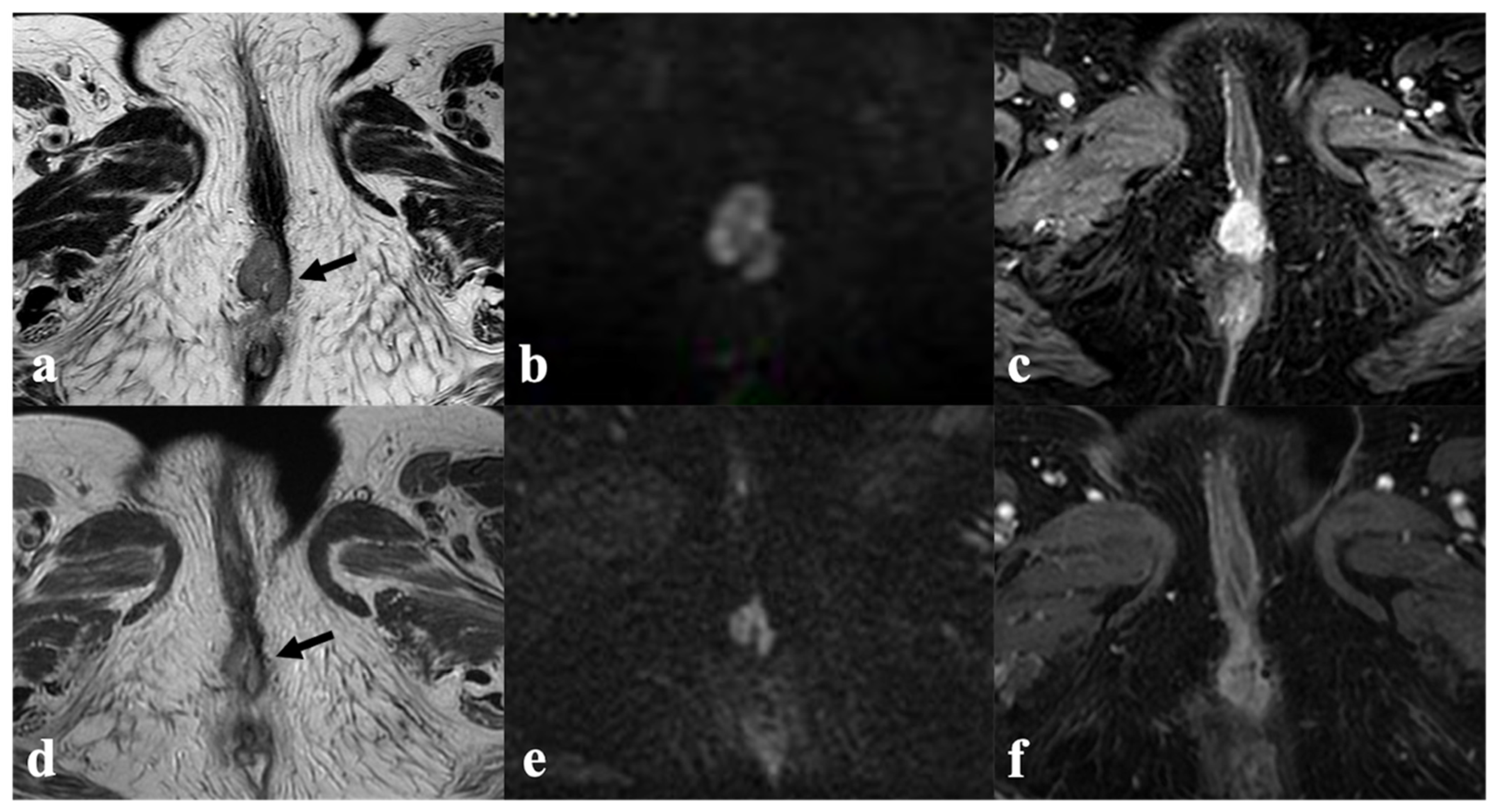 Cancers 14 03852 g008 Cancers 14 03852 g008