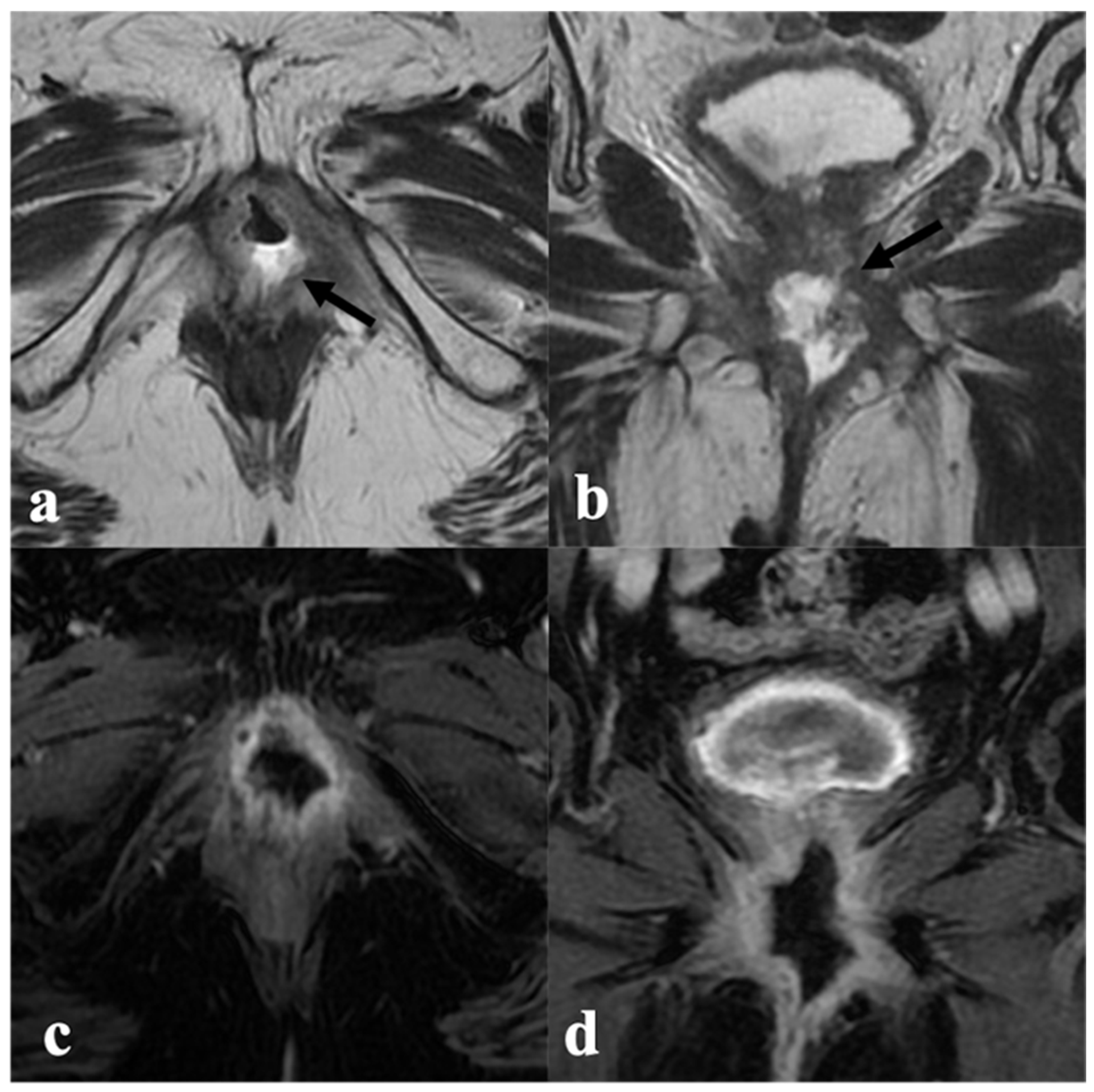 Cancers 14 03852 g009 Cancers 14 03852 g009