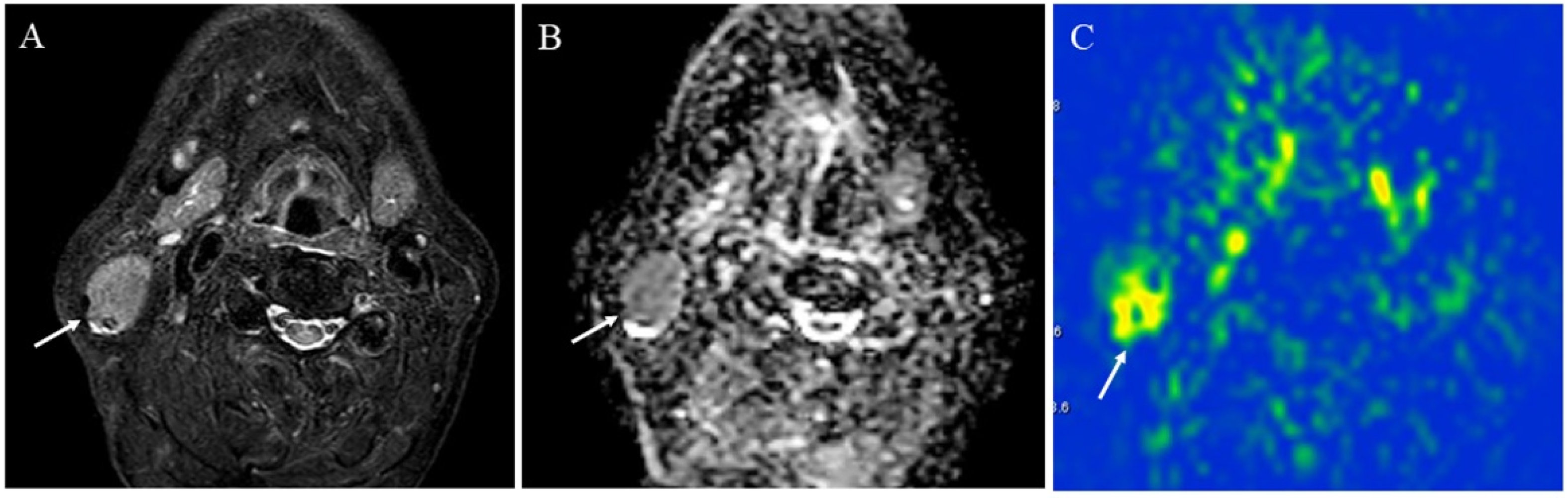 Cancers 14 03872 g011