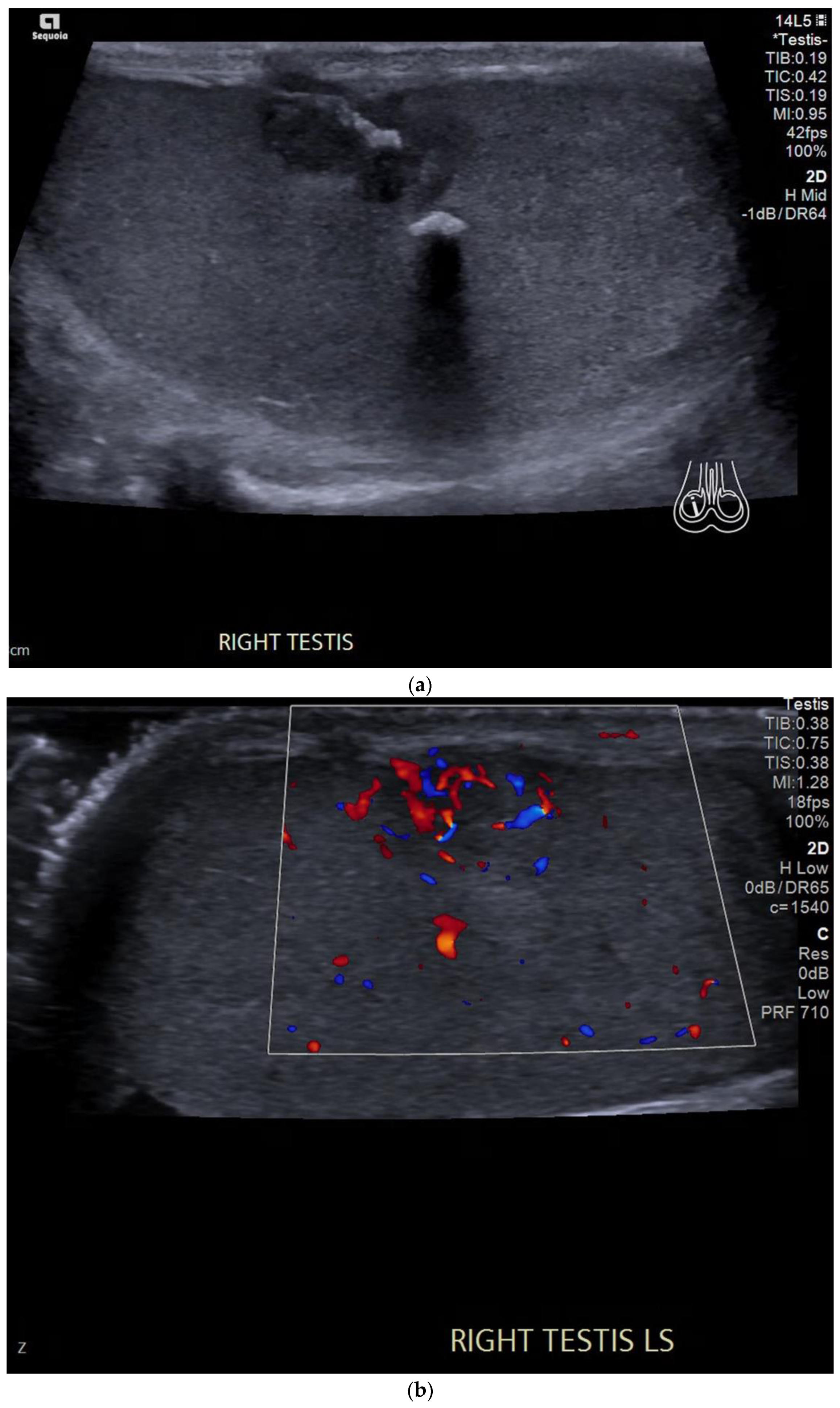 Cancers 14 03882 g002 Cancers 14 03882 g002