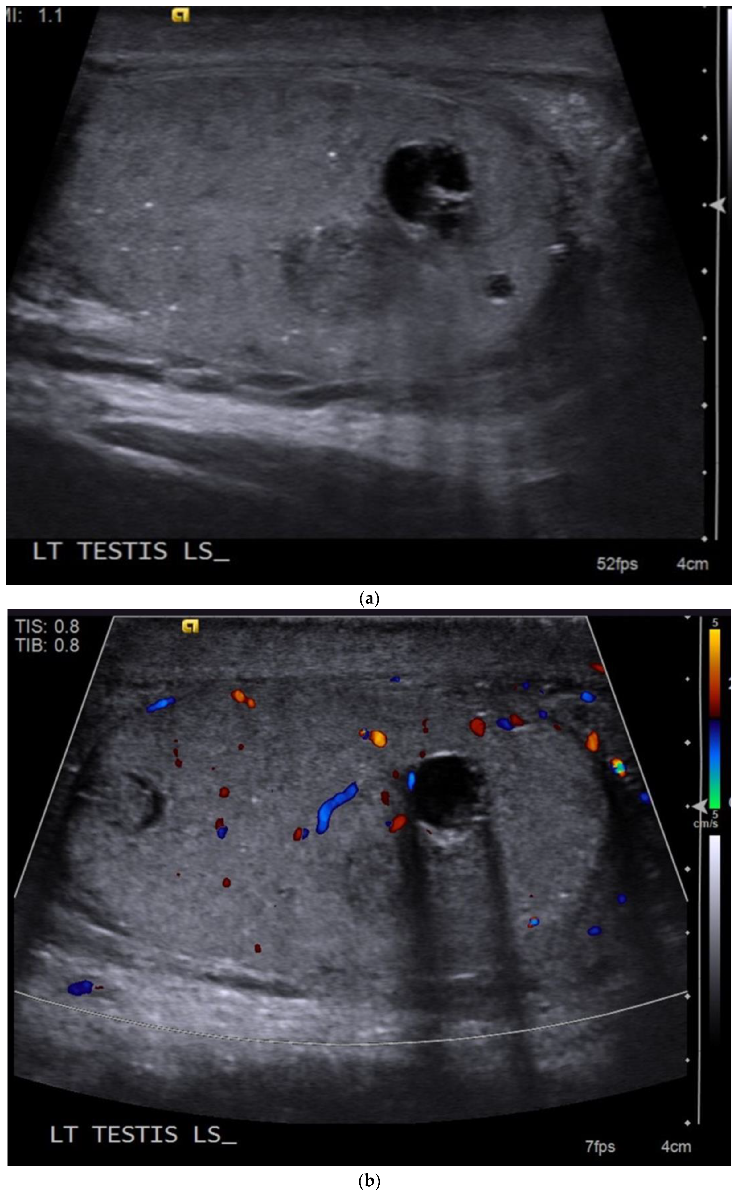 Cancers 14 03882 g003 Cancers 14 03882 g003