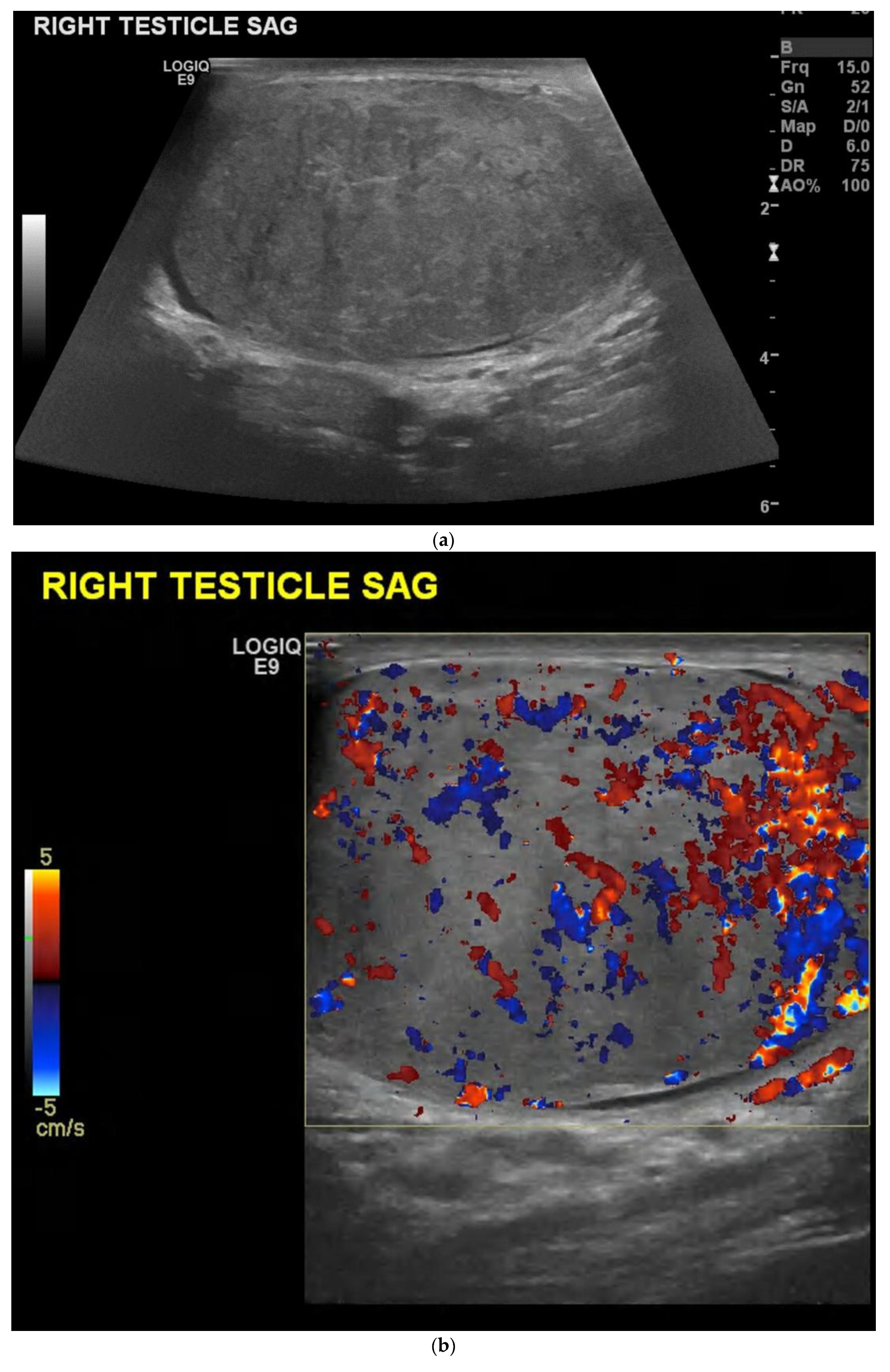 Cancers 14 03882 g004 Cancers 14 03882 g004