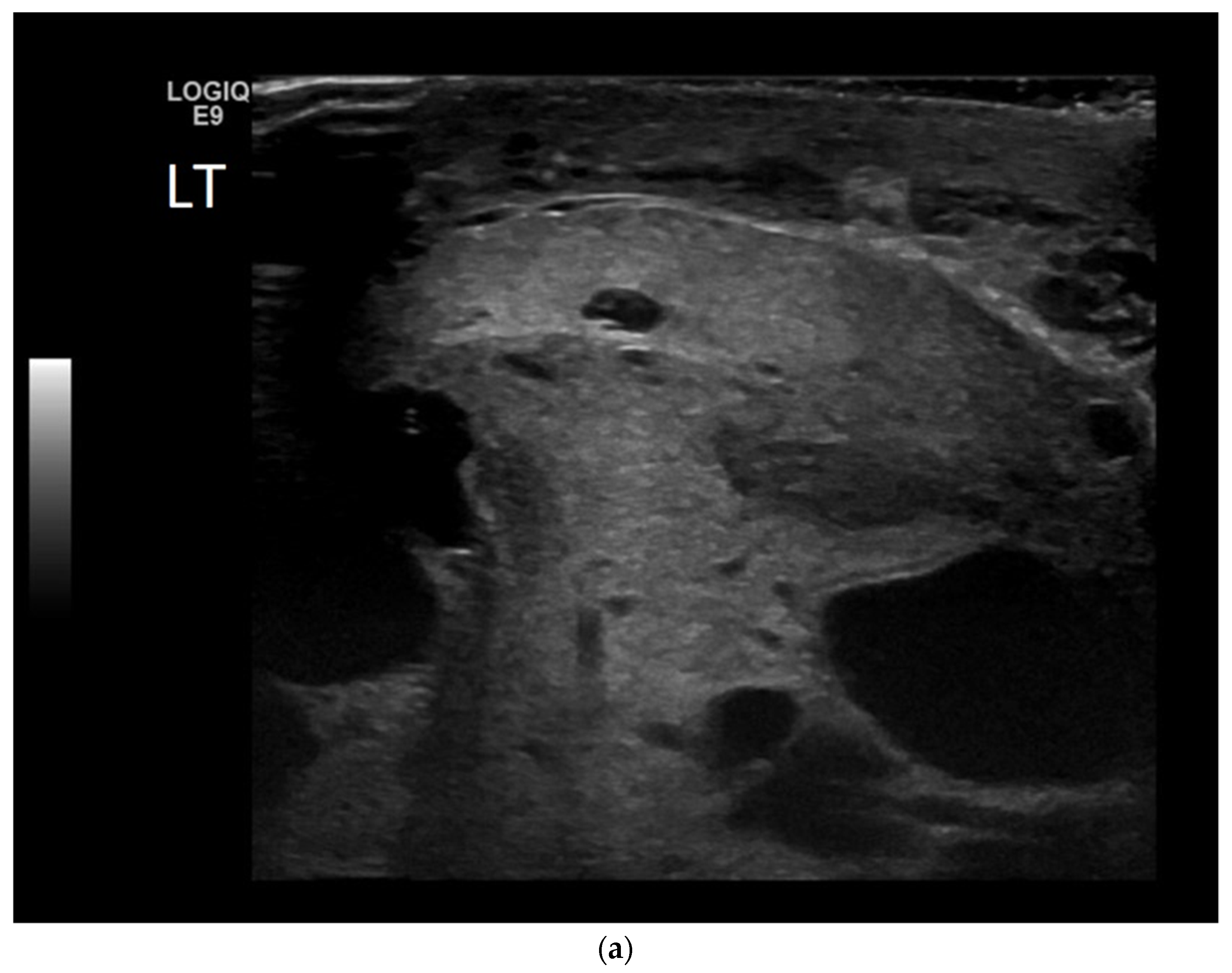 Cancers 14 03882 g005a Cancers 14 03882 g005a