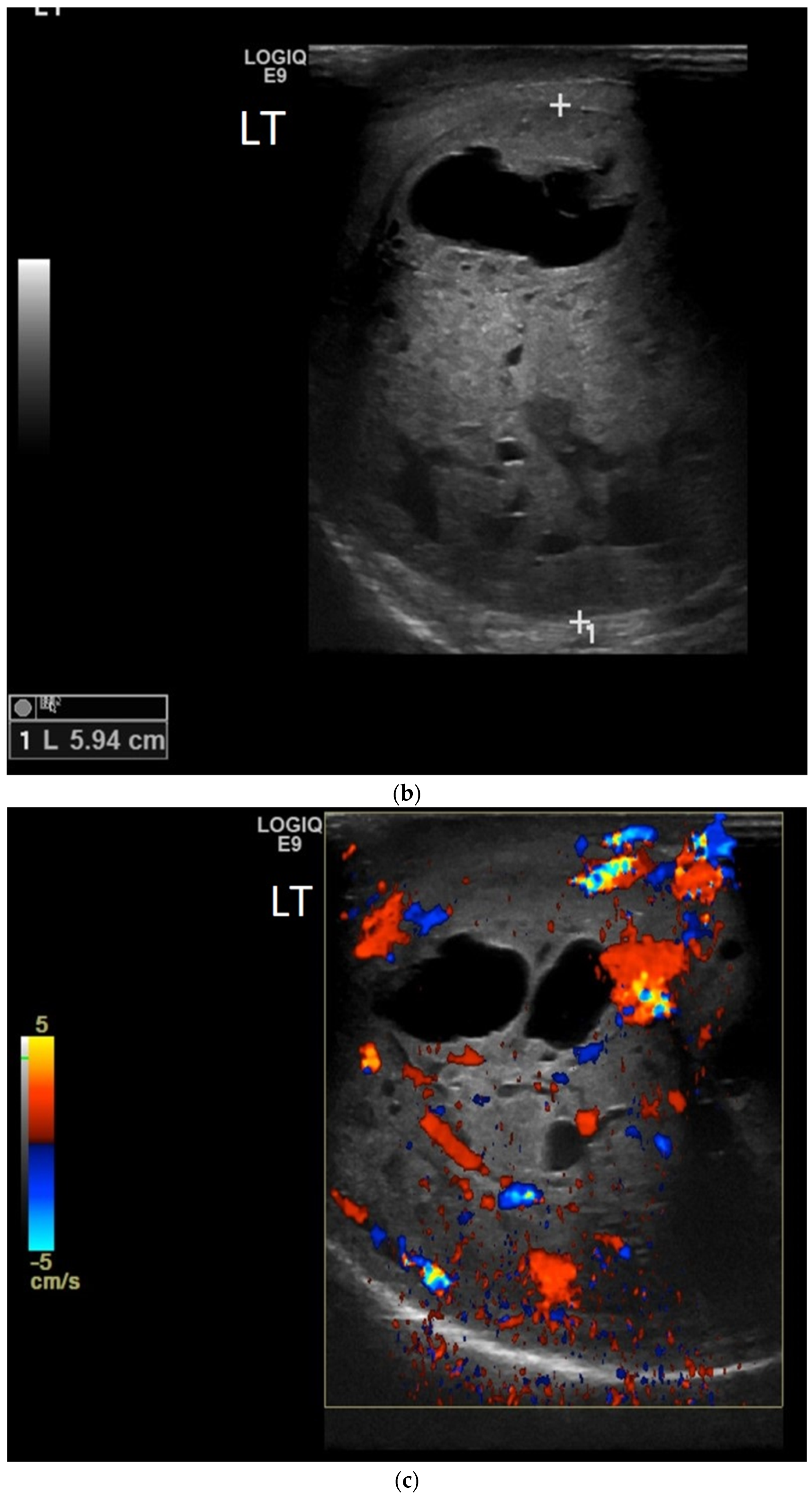 Cancers 14 03882 g005b Cancers 14 03882 g005b