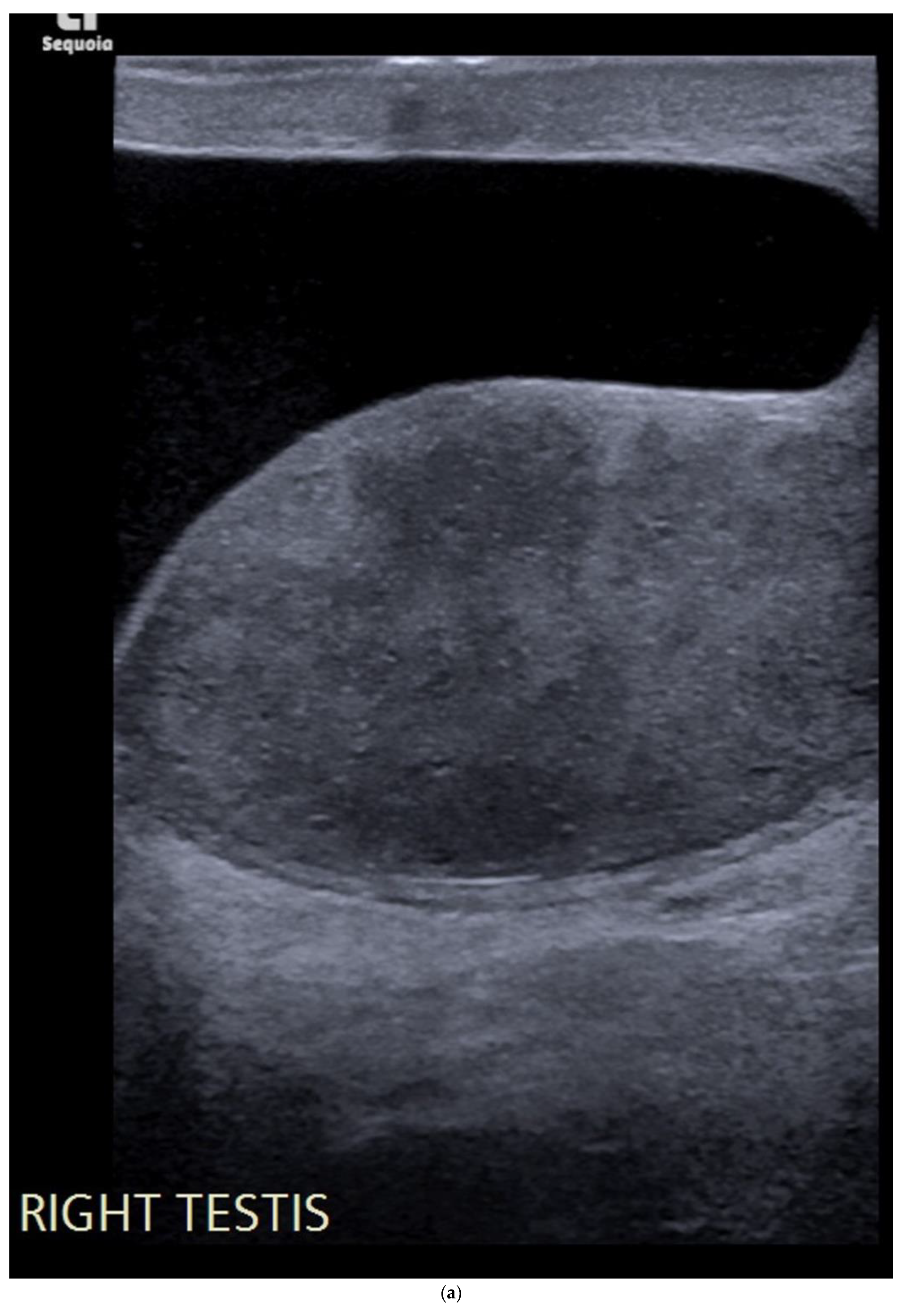 Cancers 14 03882 g006a Cancers 14 03882 g006a