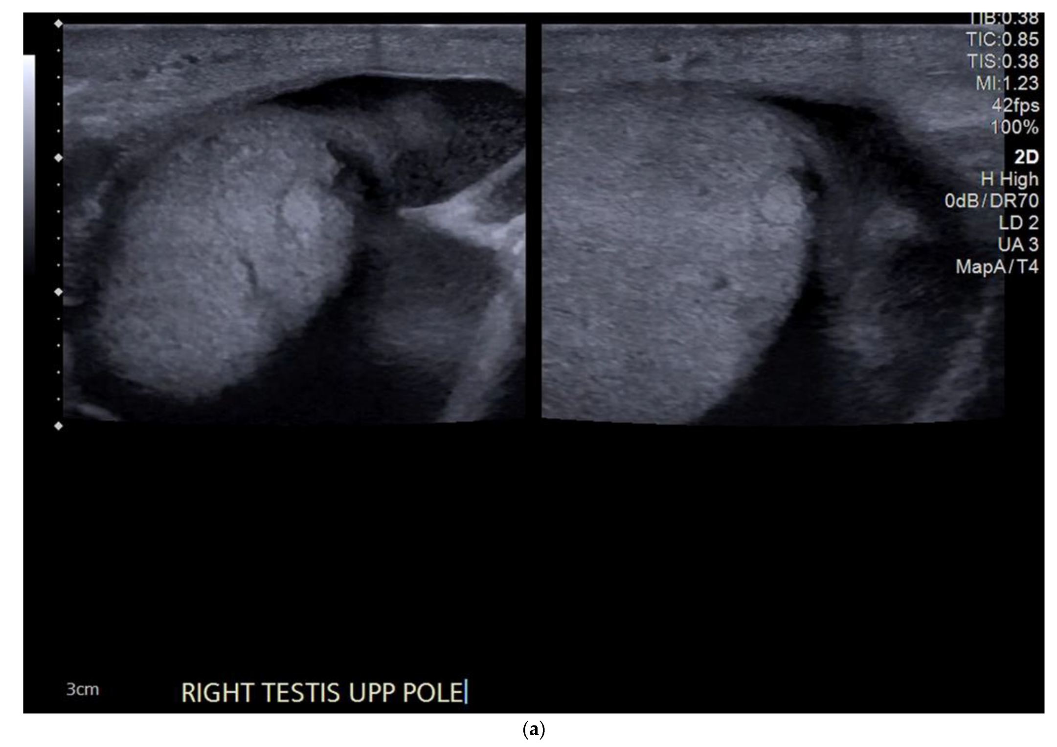 Cancers 14 03882 g007a Cancers 14 03882 g007a