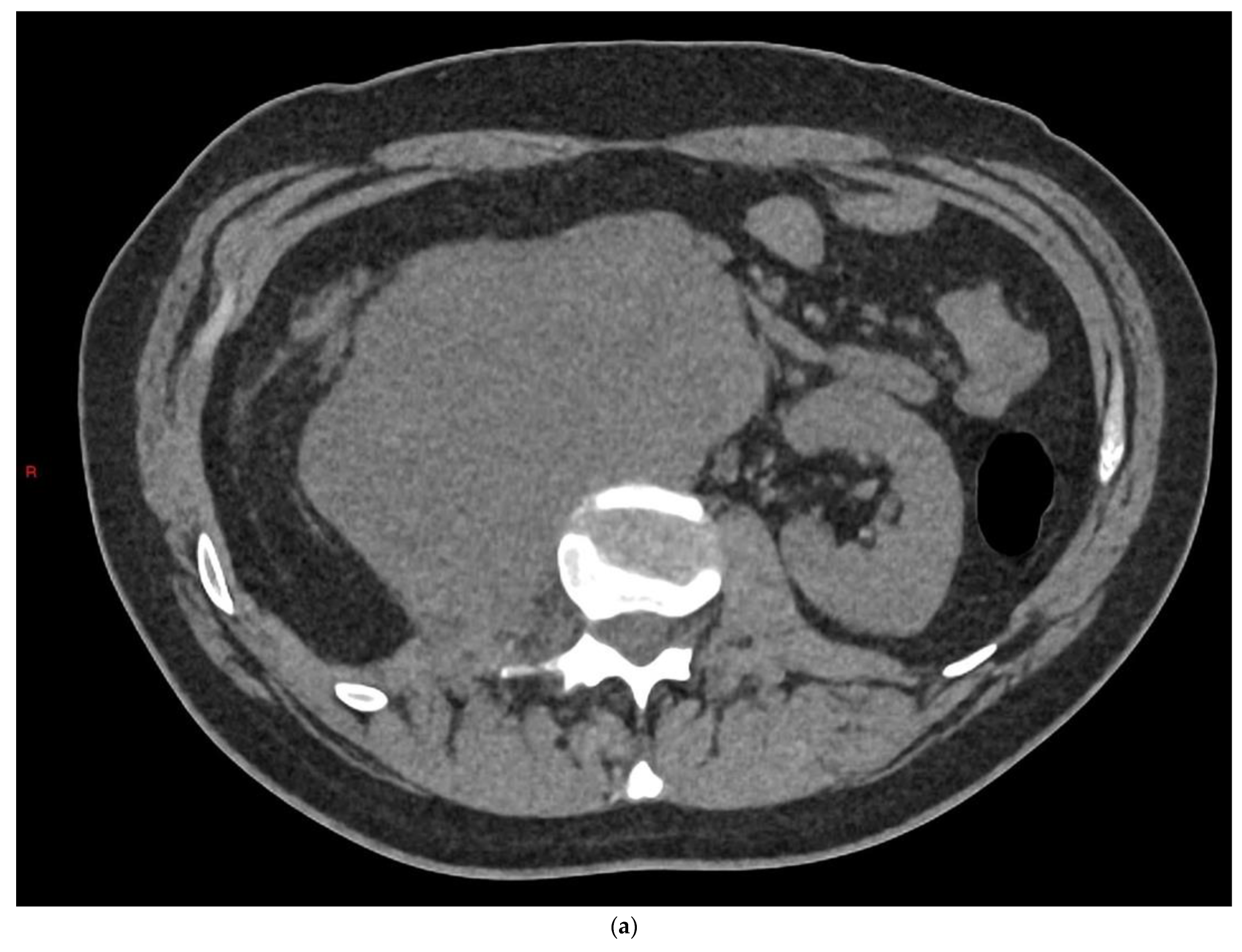 Cancers 14 03882 g008a Cancers 14 03882 g008a