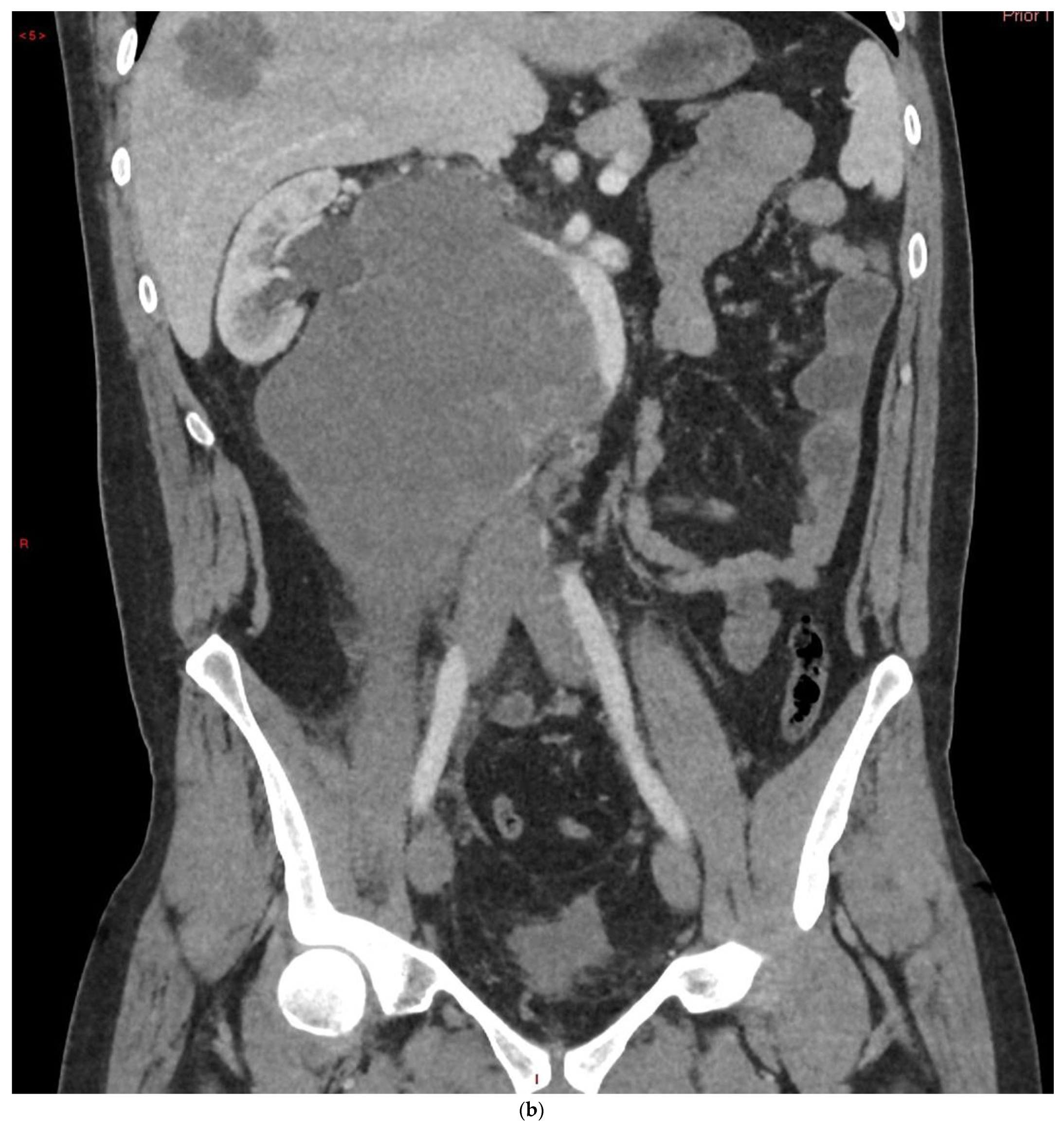 Cancers 14 03882 g008b Cancers 14 03882 g008b