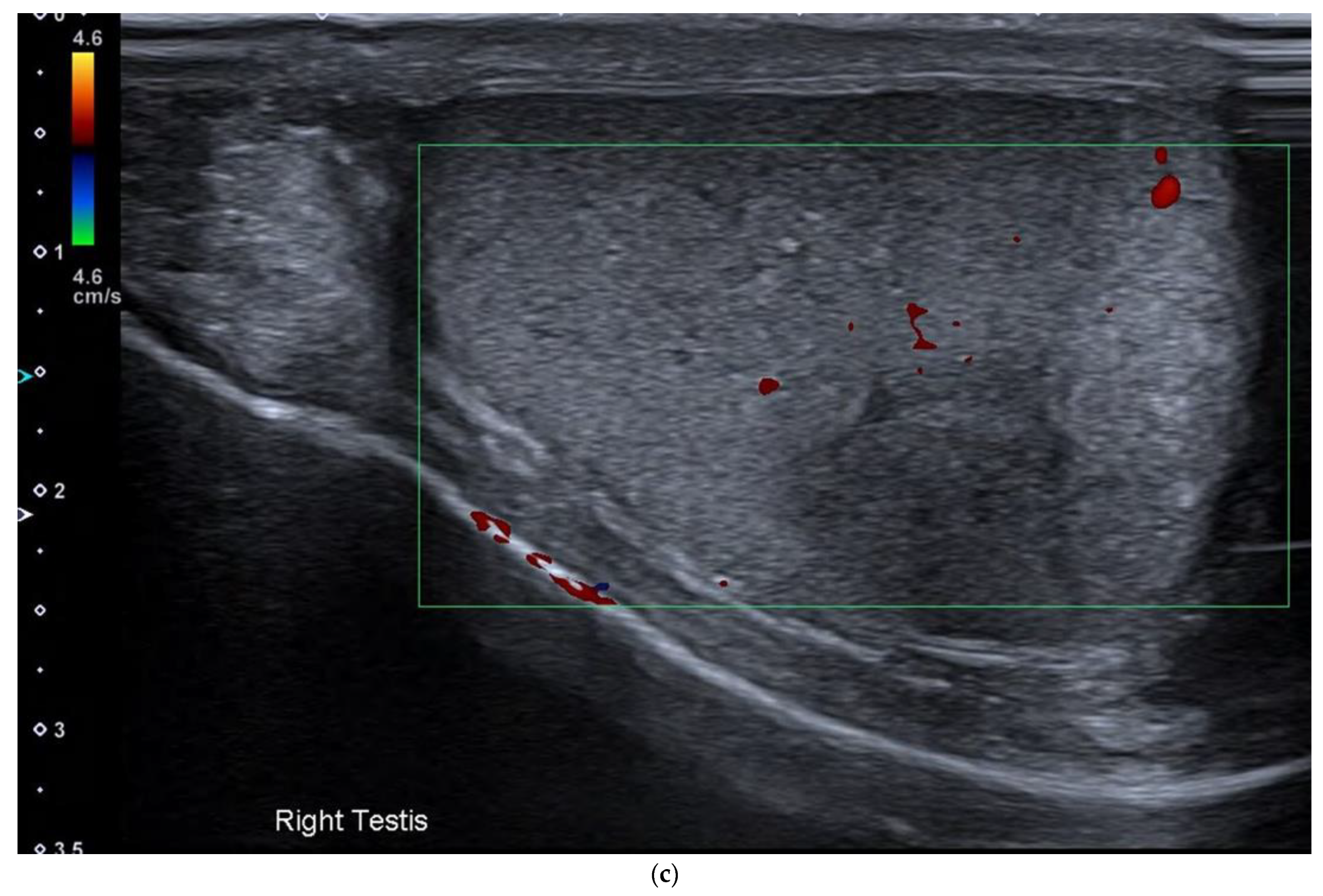 Cancers 14 03882 g008c Cancers 14 03882 g008c