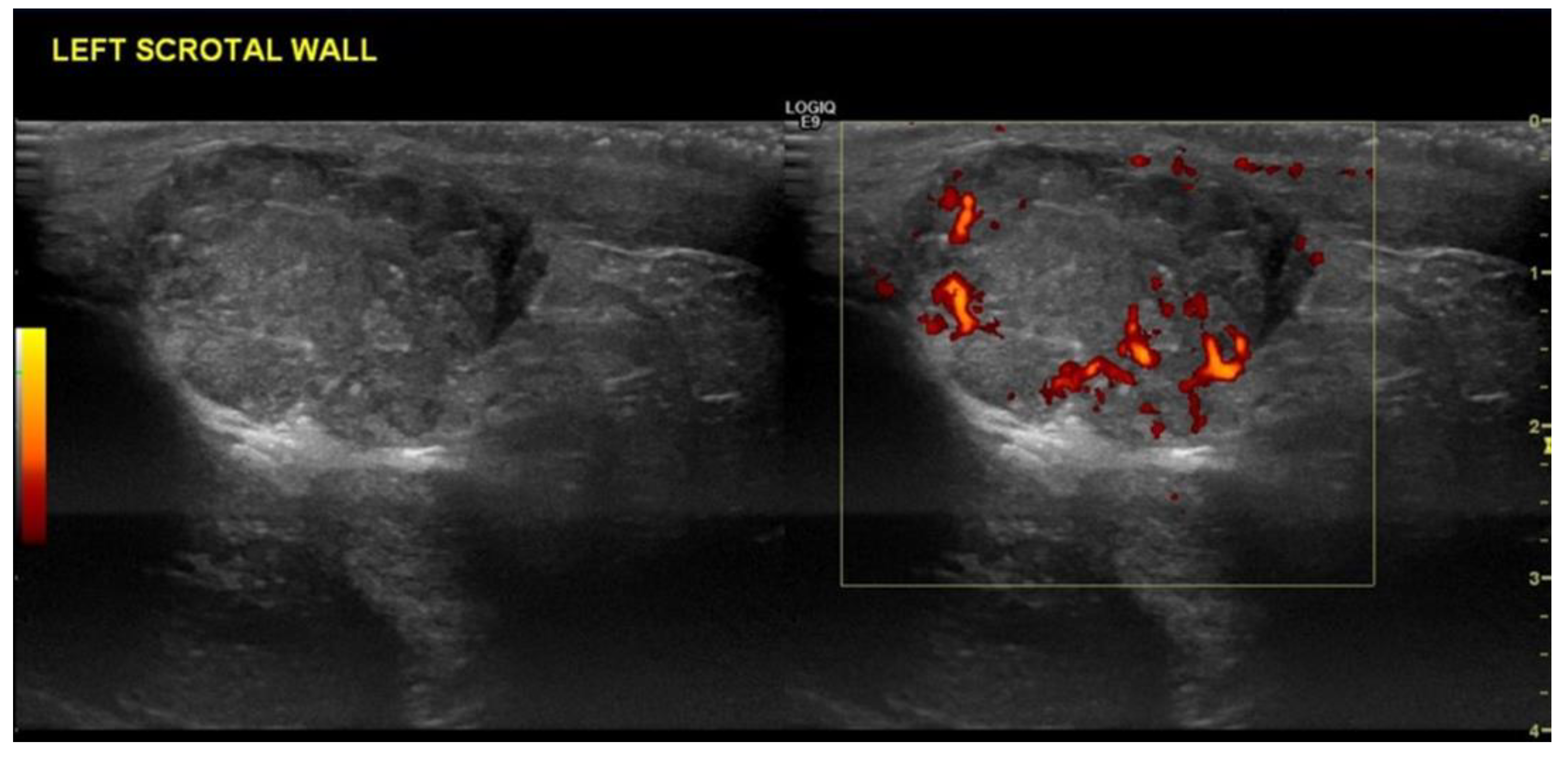 Cancers 14 03882 g009 Cancers 14 03882 g009