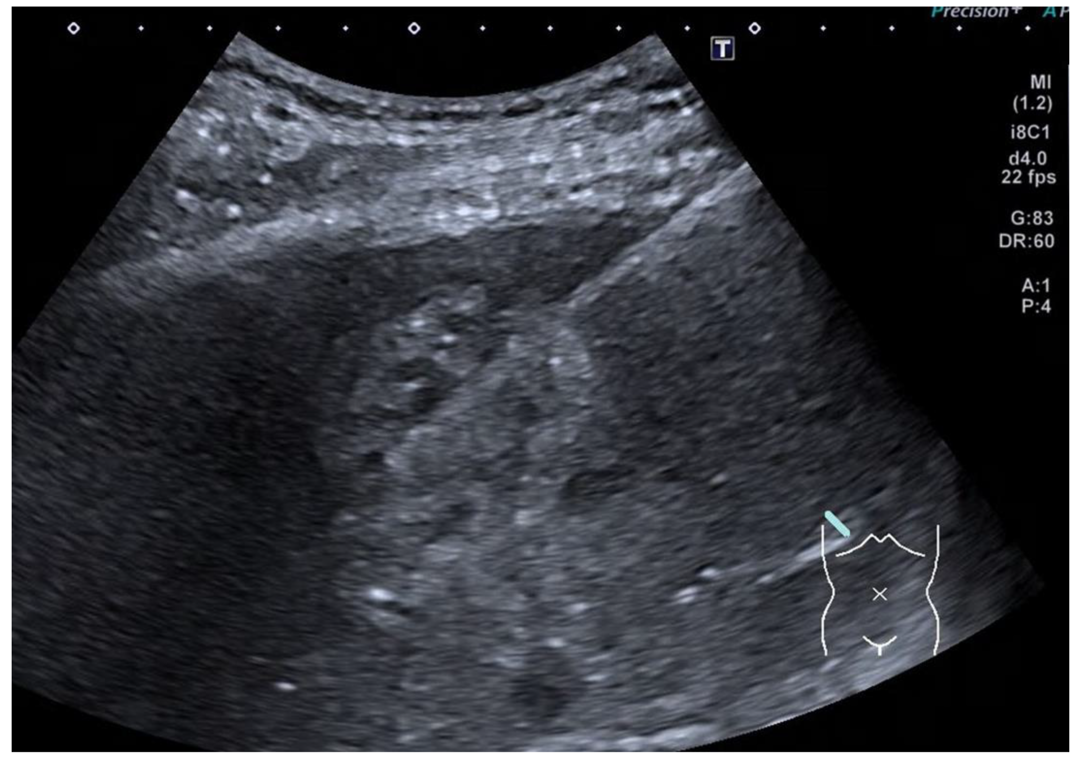 Cancers 14 03882 g010 Cancers 14 03882 g010