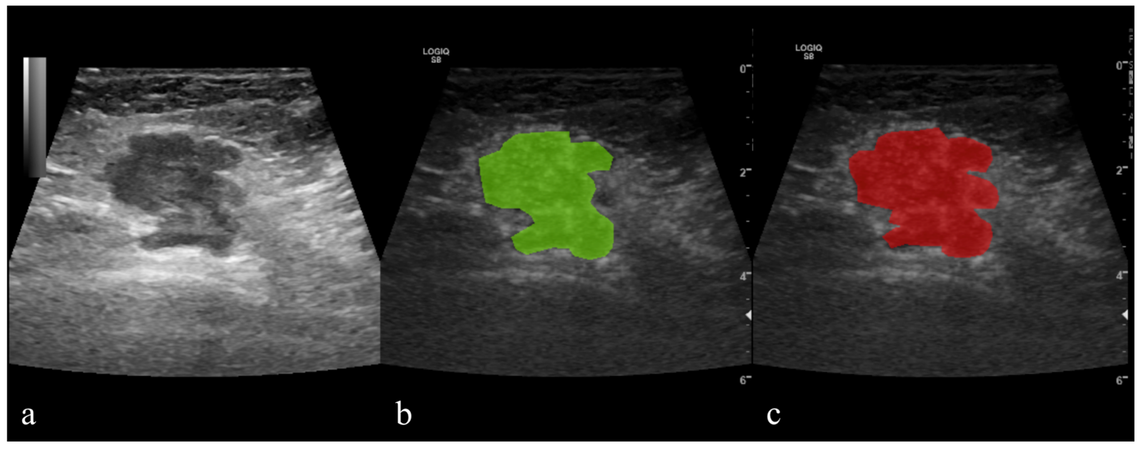 Cancers 14 03905 g002 Cancers 14 03905 g002