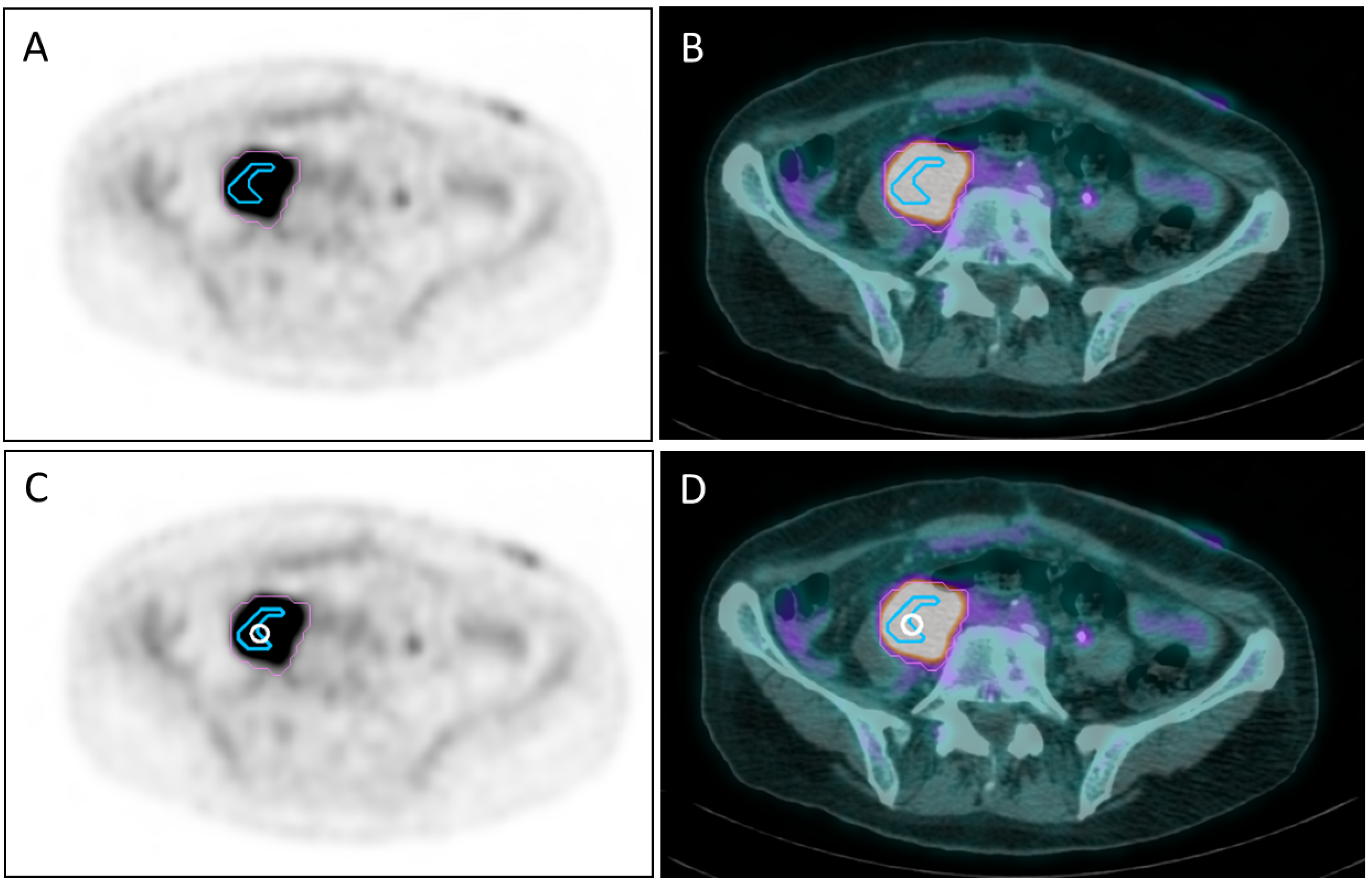 Cancers 14 03909 g001