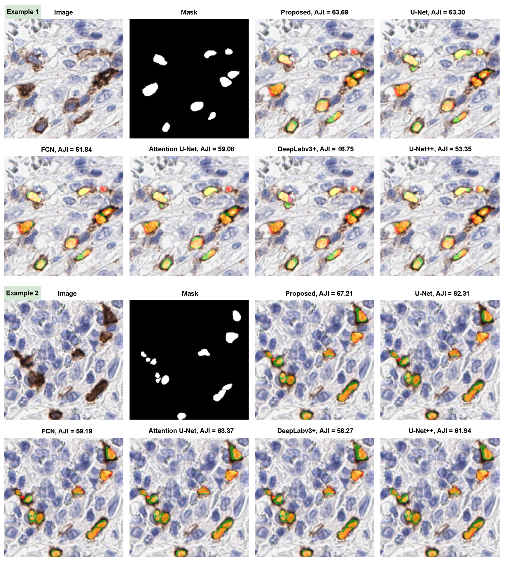 Cancers 14 03910 g005