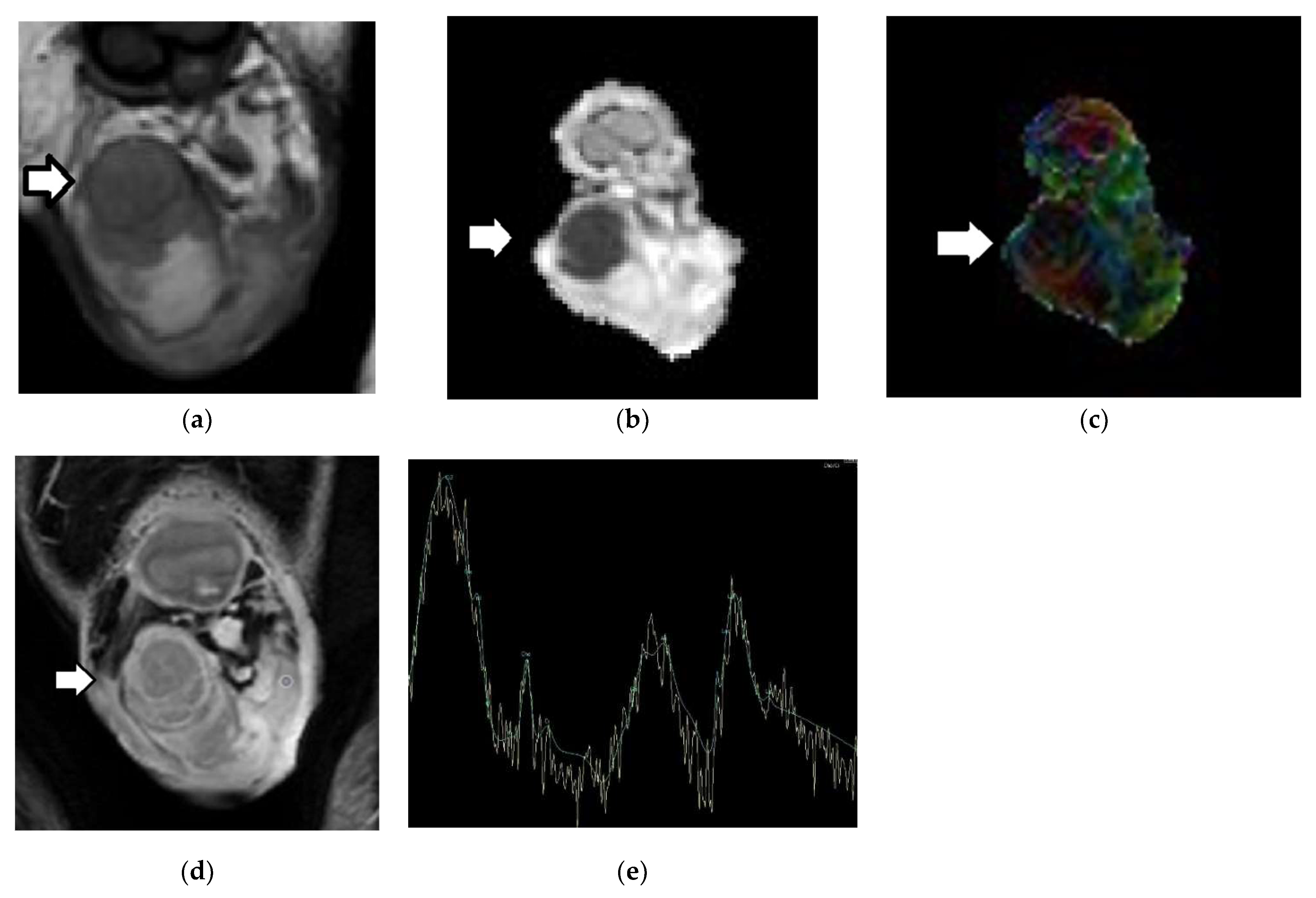 Cancers 14 03912 g002 Cancers 14 03912 g002