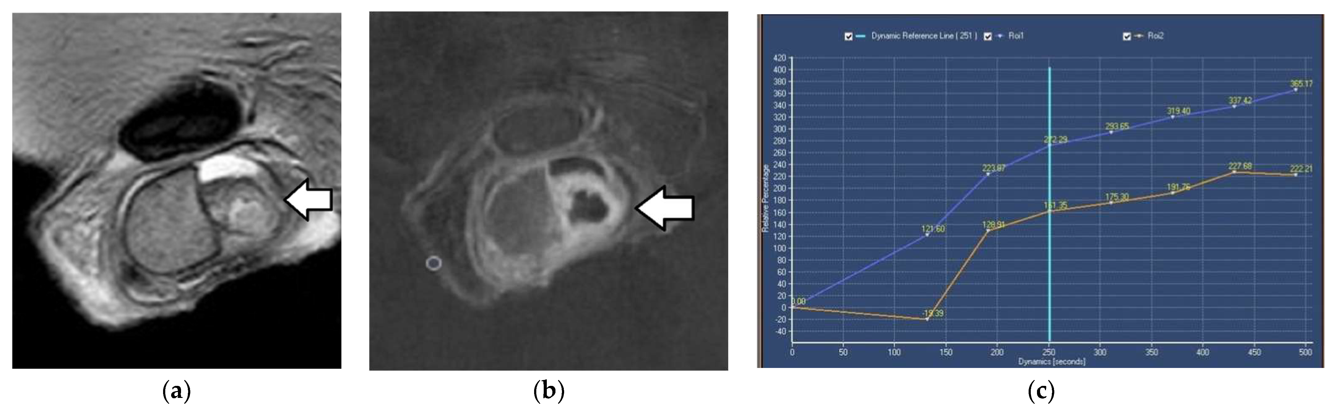Cancers 14 03912 g003 Cancers 14 03912 g003