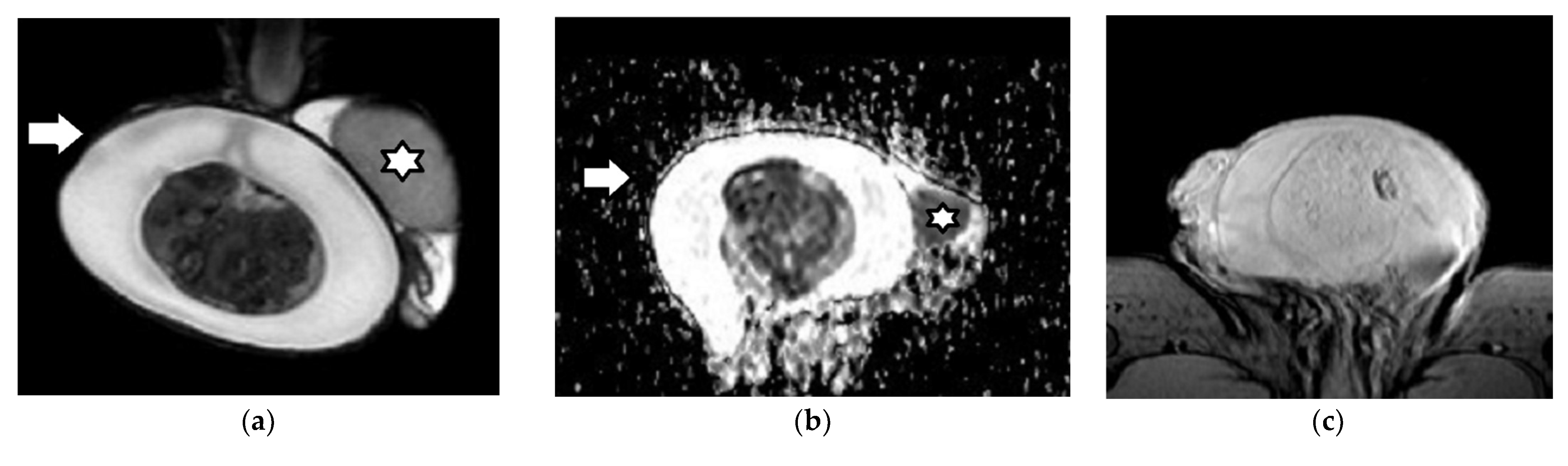 Cancers 14 03912 g005a Cancers 14 03912 g005a