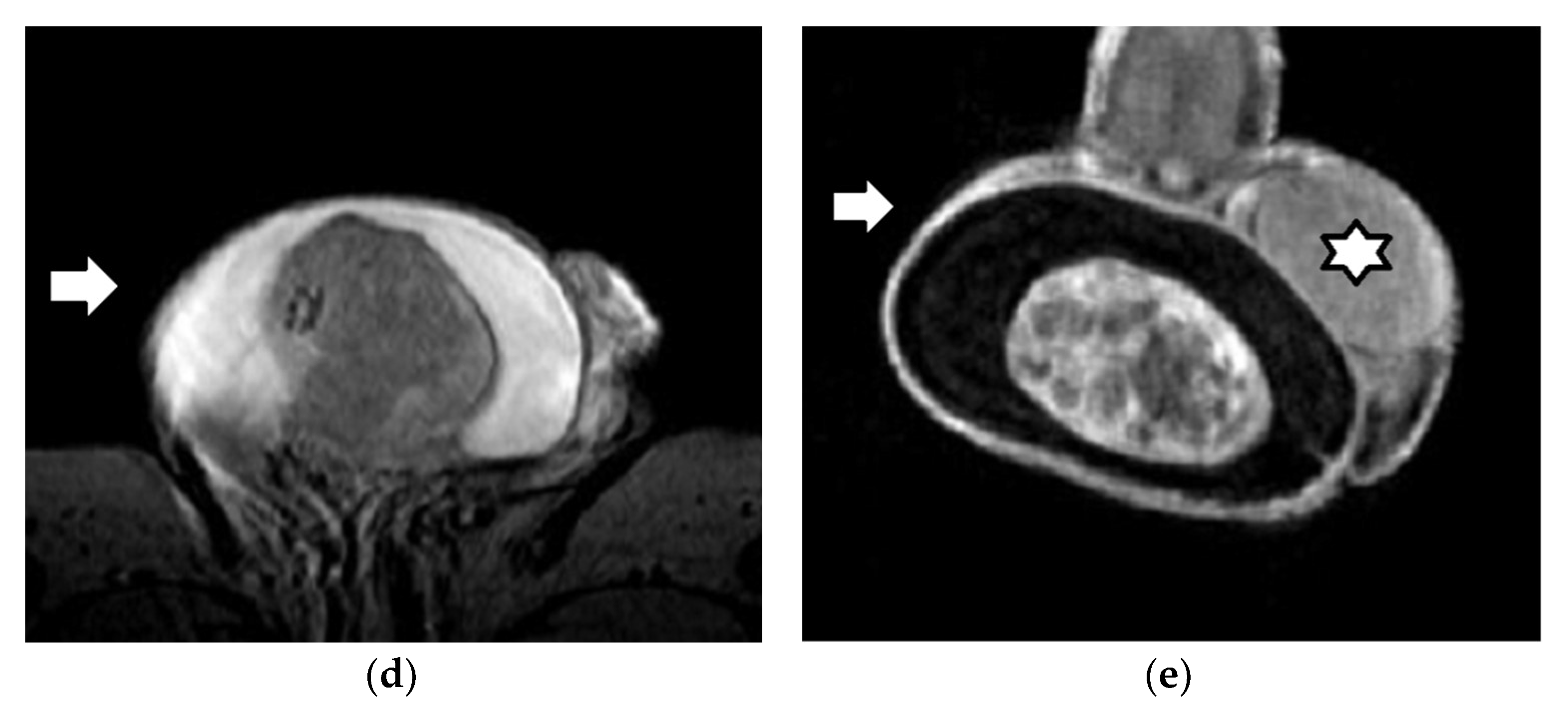 Cancers 14 03912 g005b Cancers 14 03912 g005b