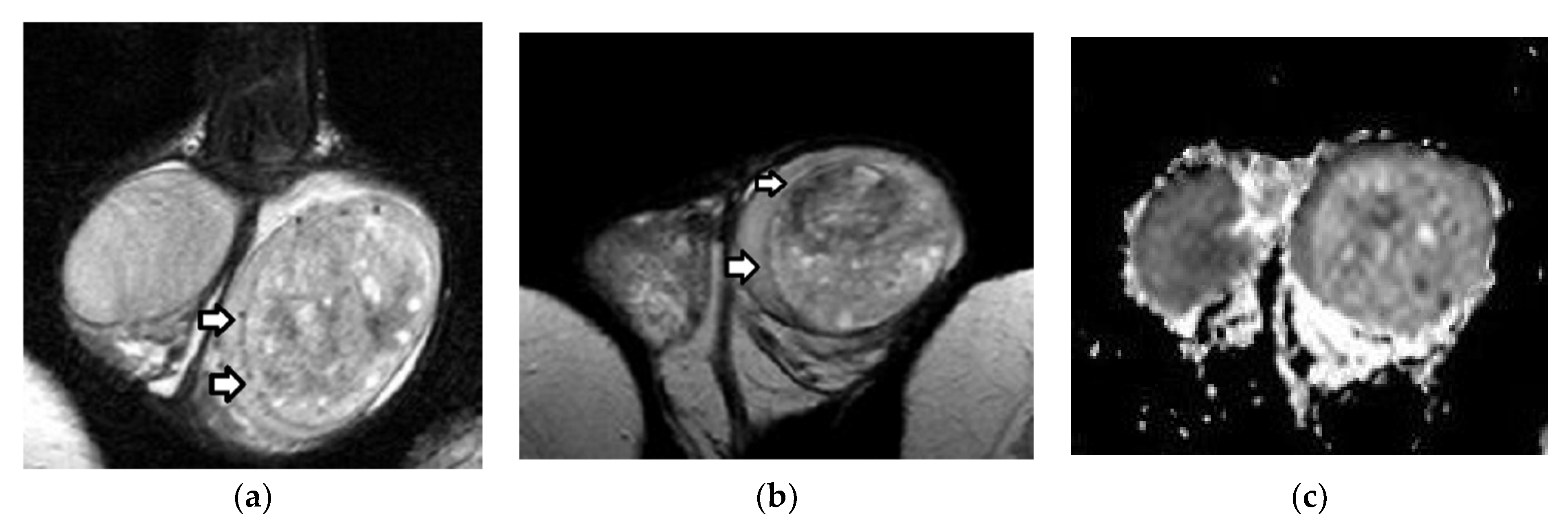 Cancers 14 03912 g006a Cancers 14 03912 g006a