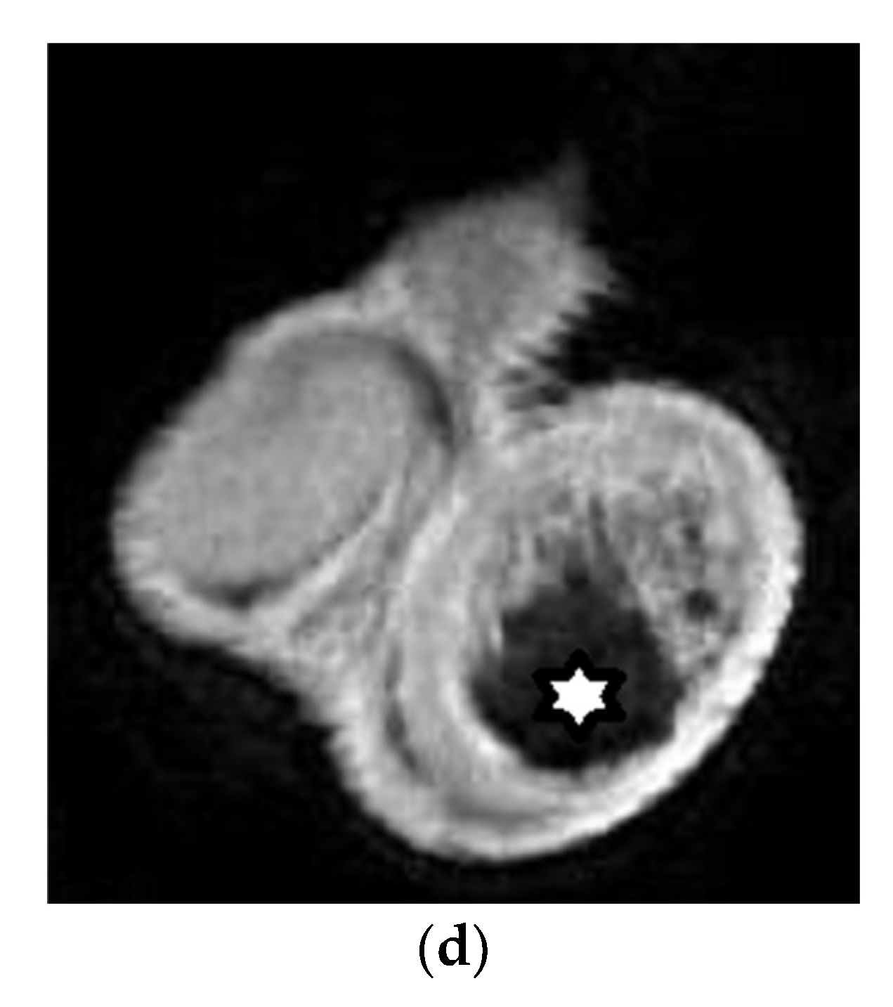 Cancers 14 03912 g006b Cancers 14 03912 g006b