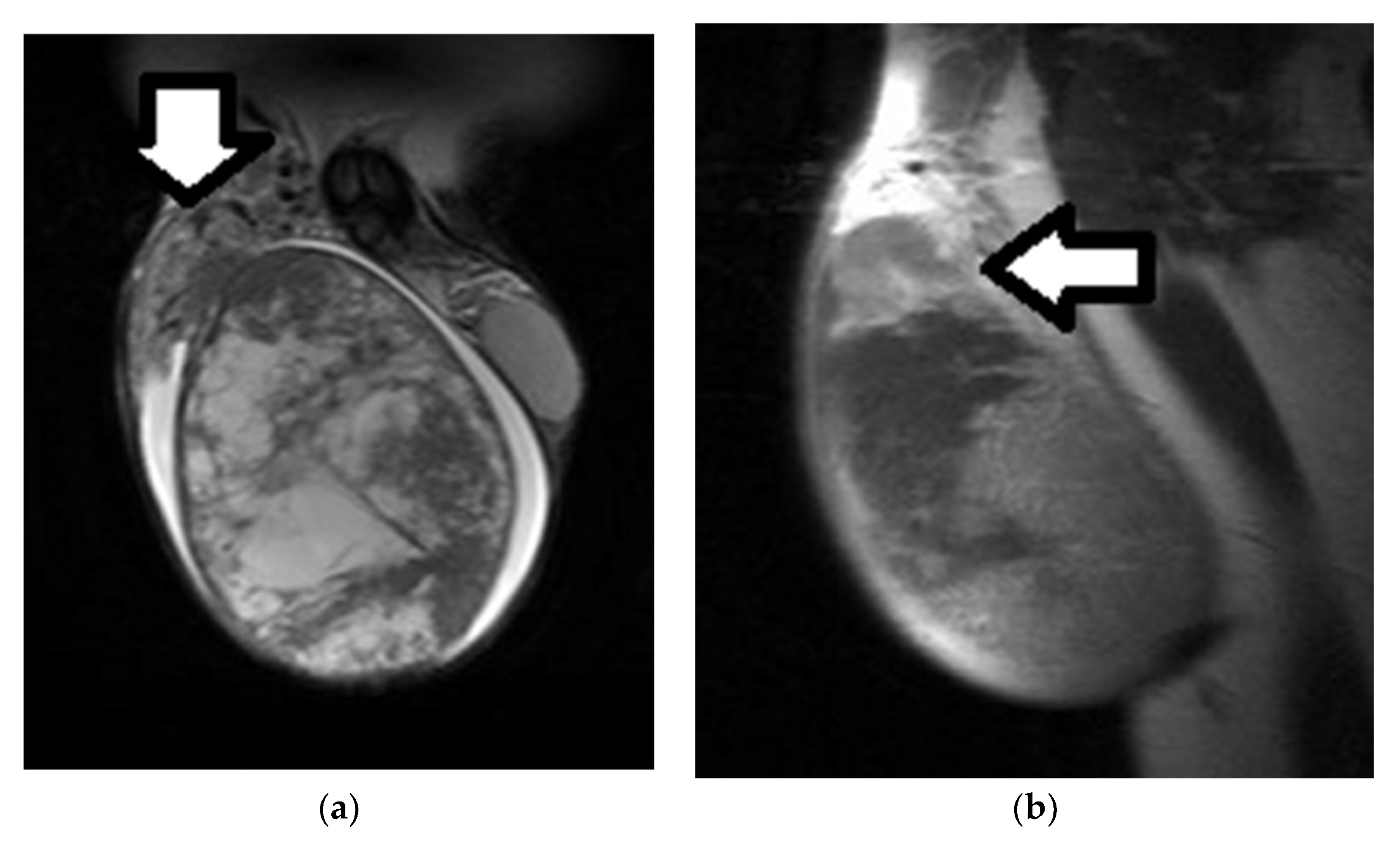 Cancers 14 03912 g007 Cancers 14 03912 g007