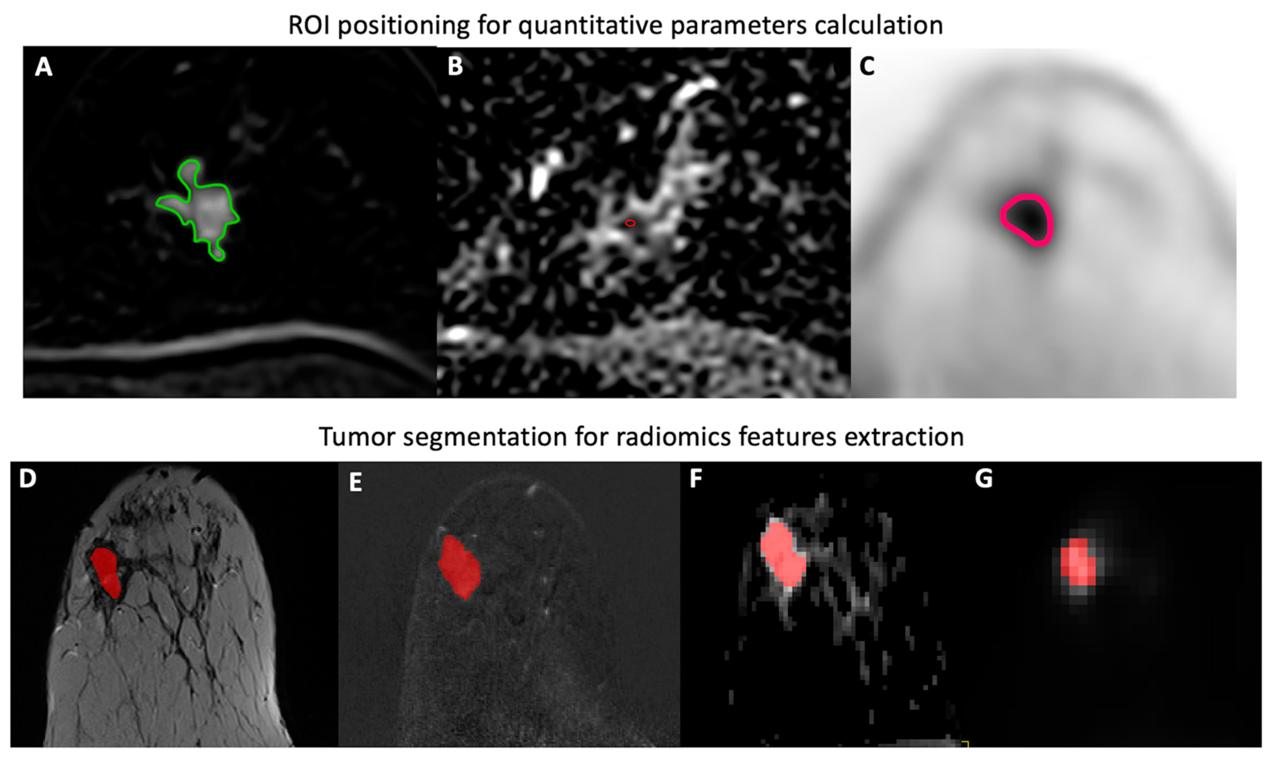 Cancers 14 03944 g001 Cancers 14 03944 g001