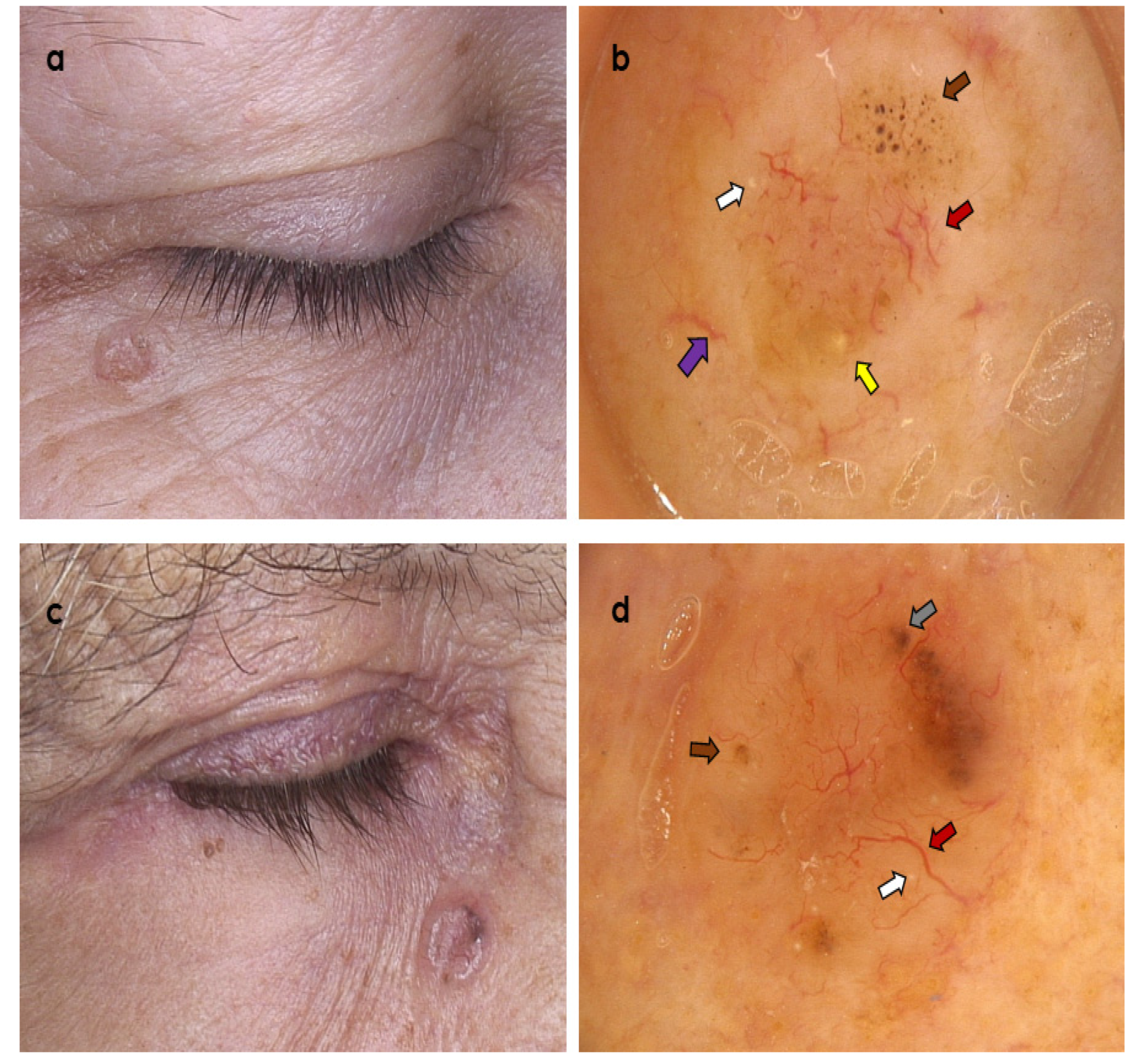 Cancers 14 03964 g002 Cancers 14 03964 g002