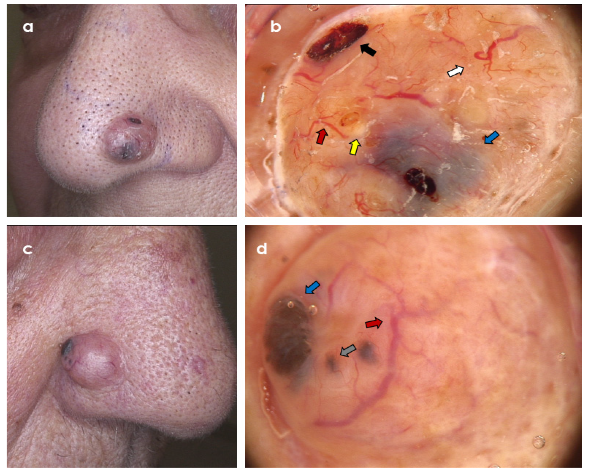 Cancers 14 03964 g003 Cancers 14 03964 g003