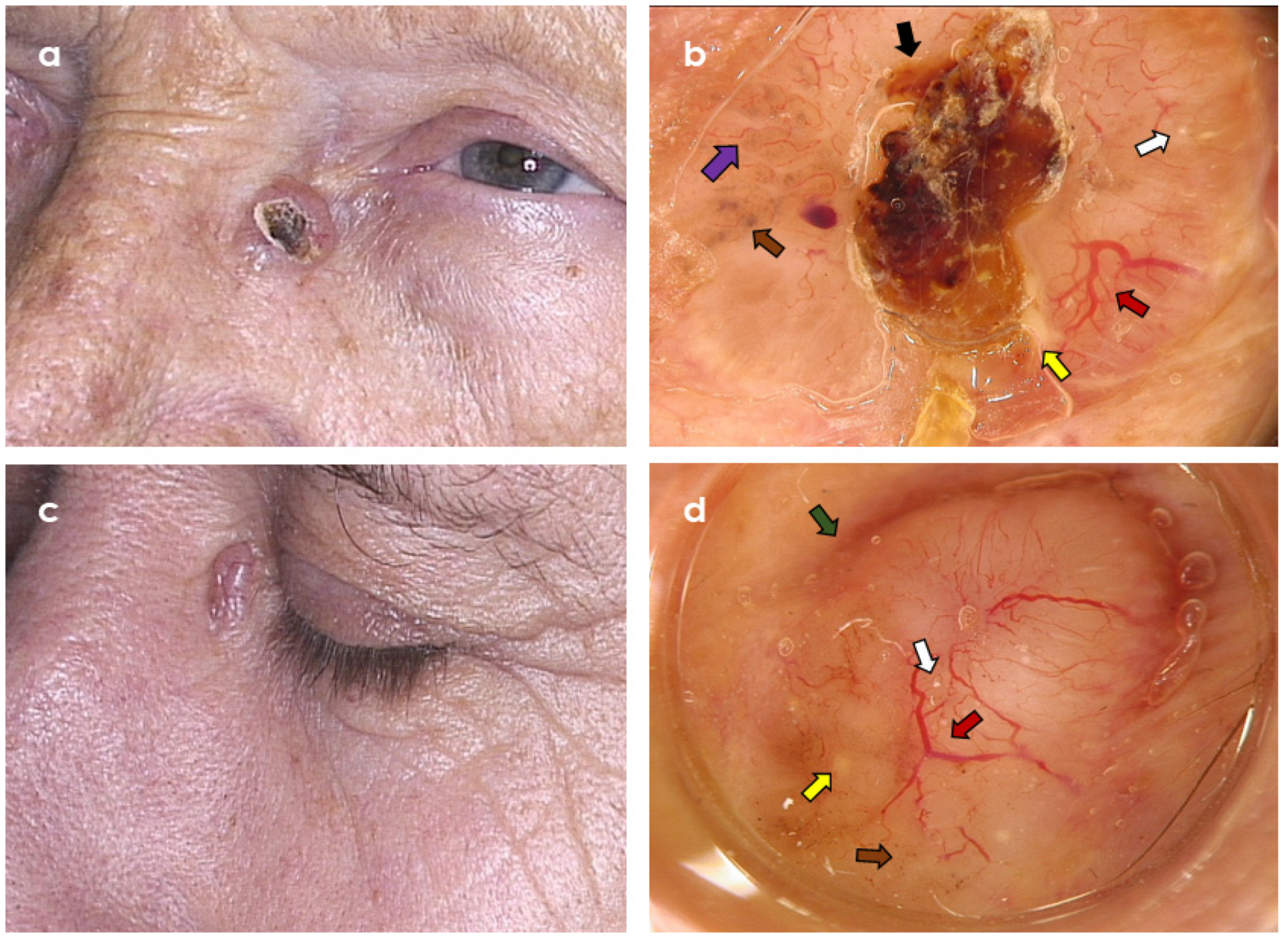 Cancers 14 03964 g004 Cancers 14 03964 g004