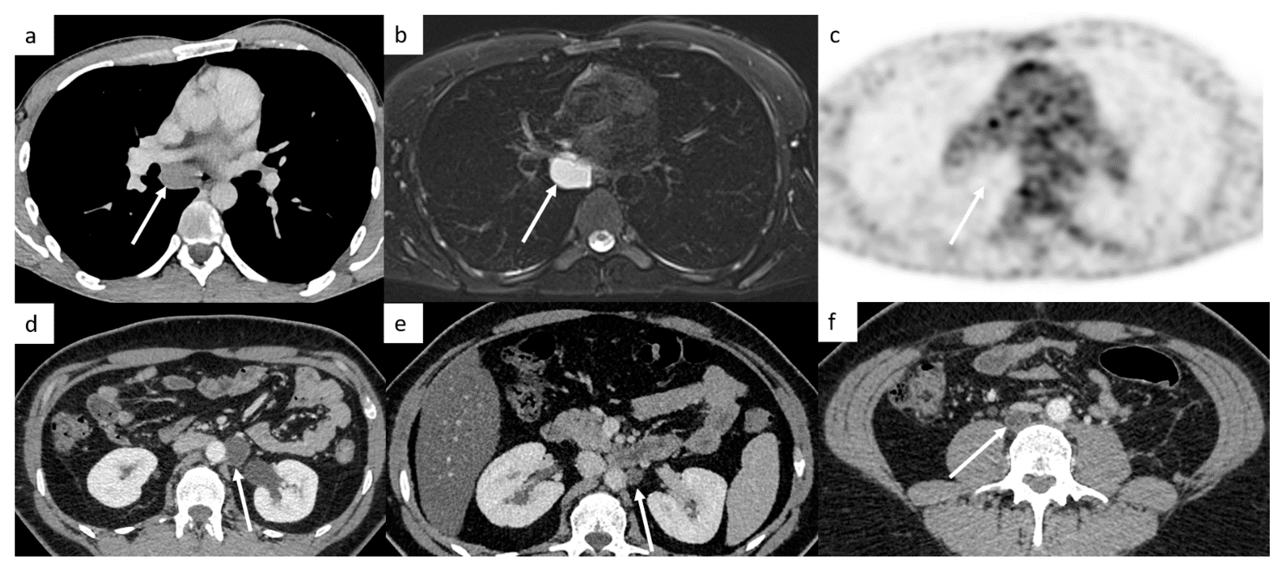 Cancers 14 03965 g007