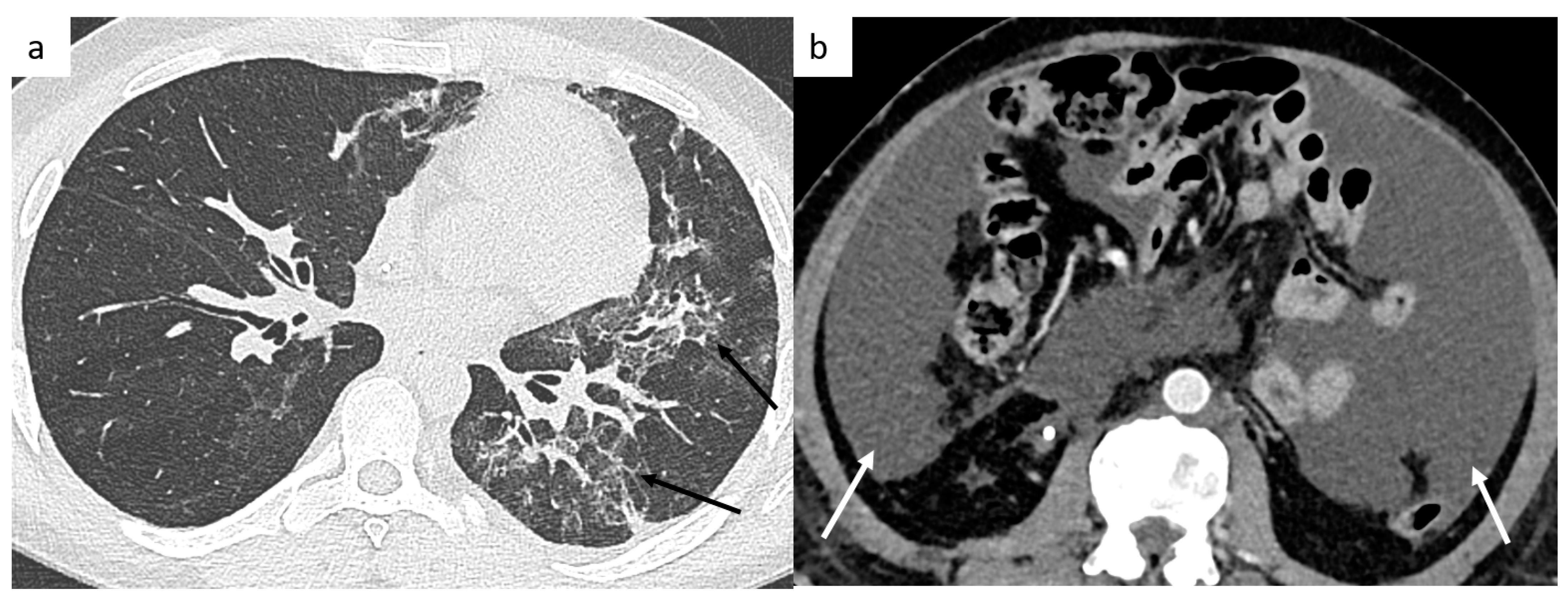 Cancers 14 03965 g008