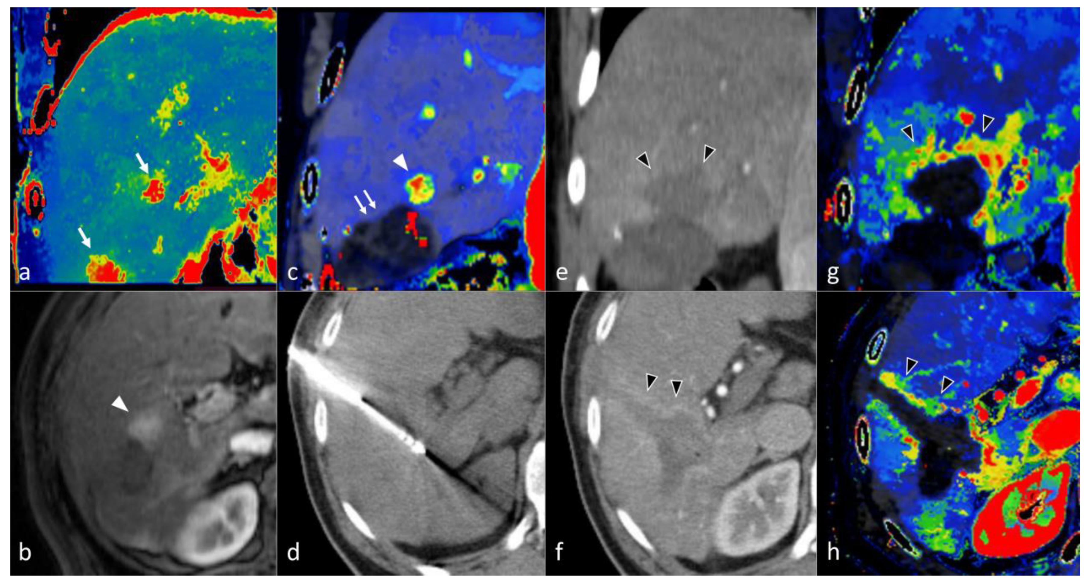Cancers 14 03997 g015 Cancers 14 03997 g015
