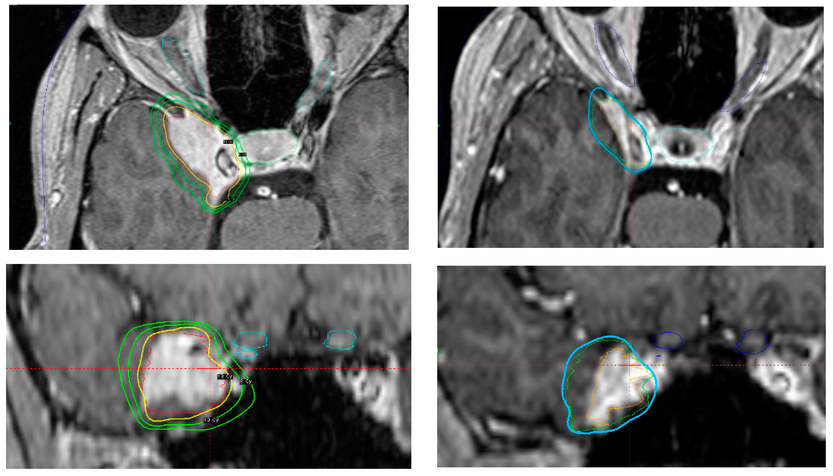 Cancers 14 04047 g005 550