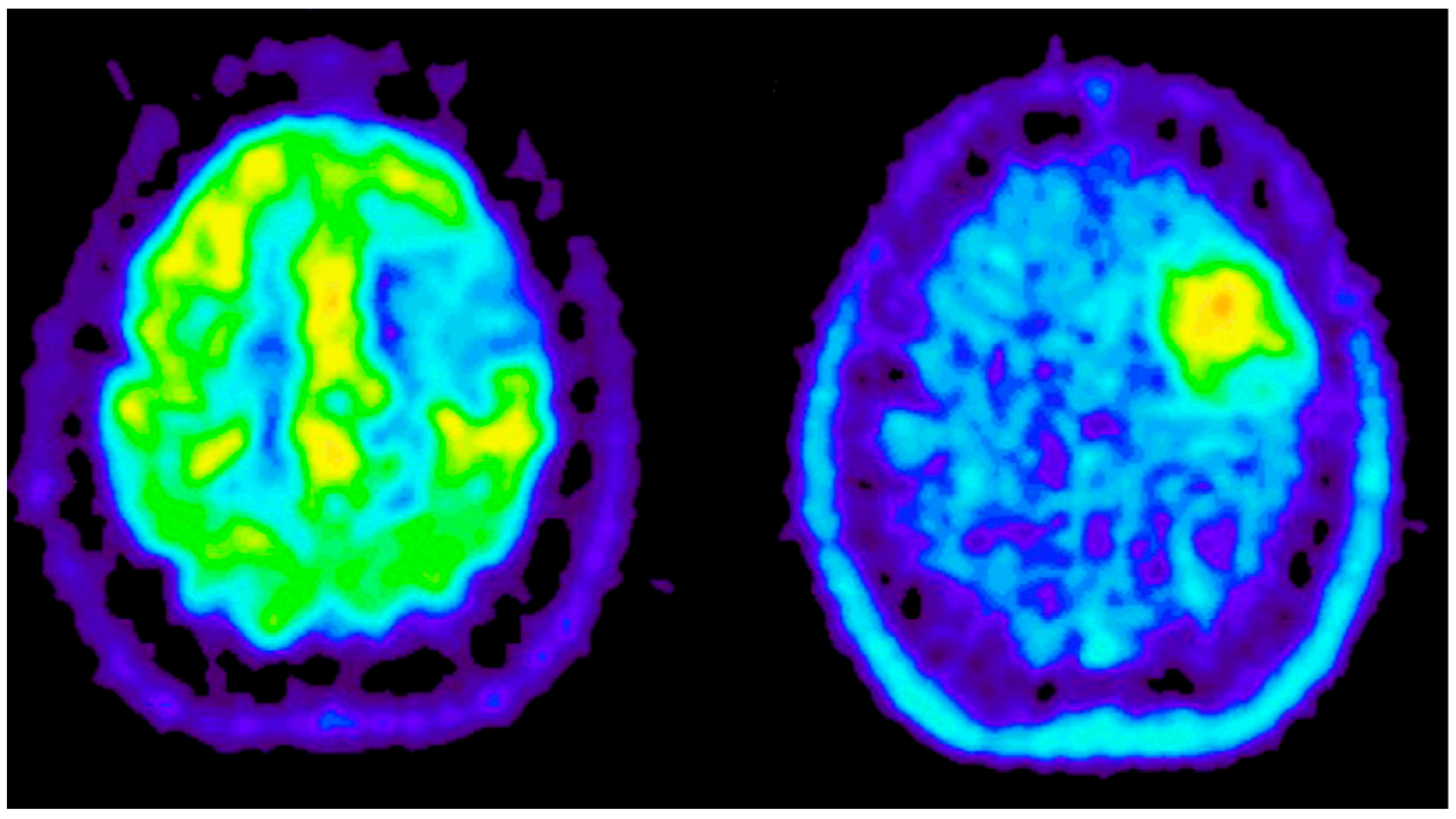 Cancers 14 04052 g0a5 Cancers 14 04052 g0a5