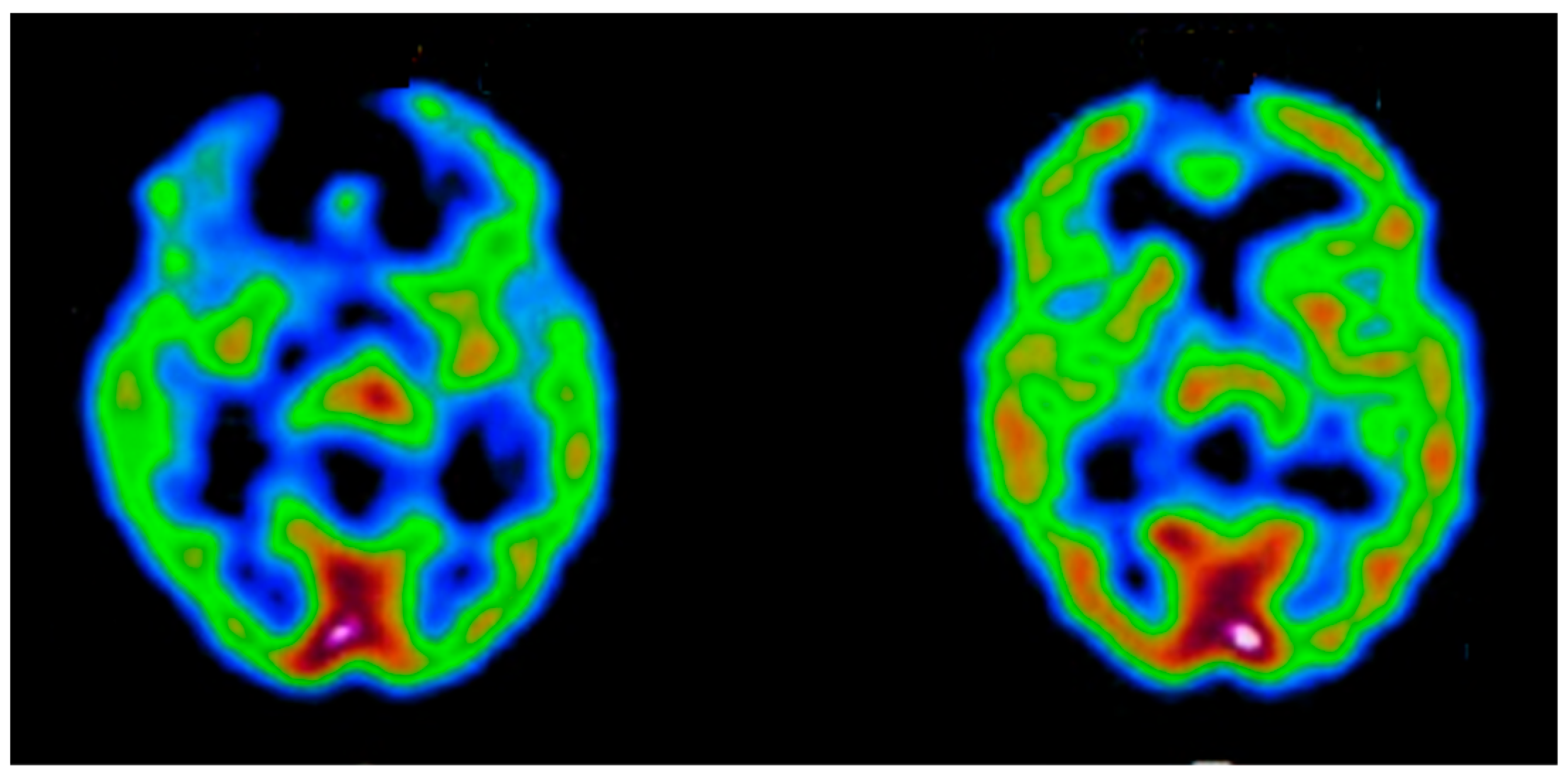 Cancers 14 04052 g0a6 Cancers 14 04052 g0a6