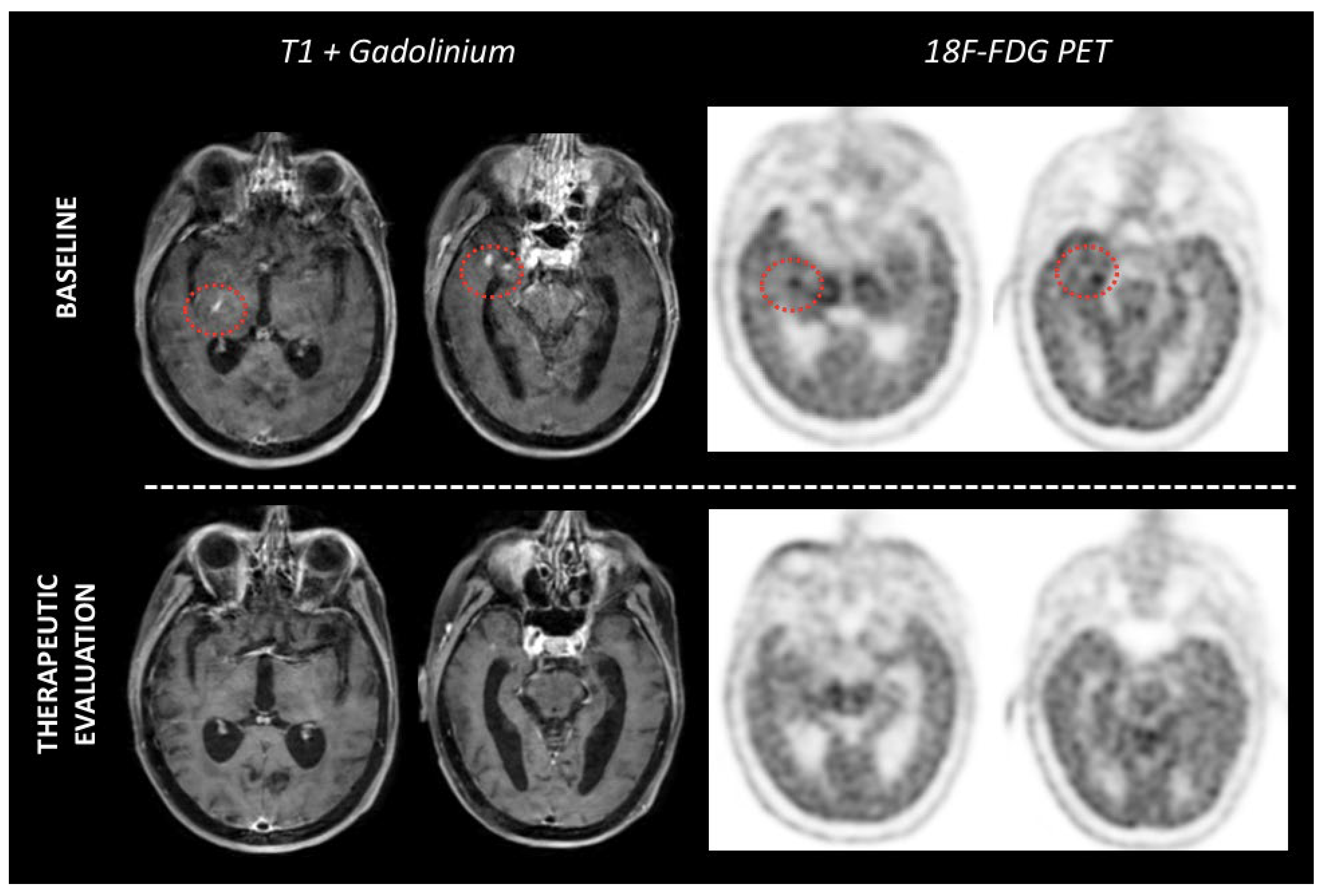 Cancers 14 04071 g004