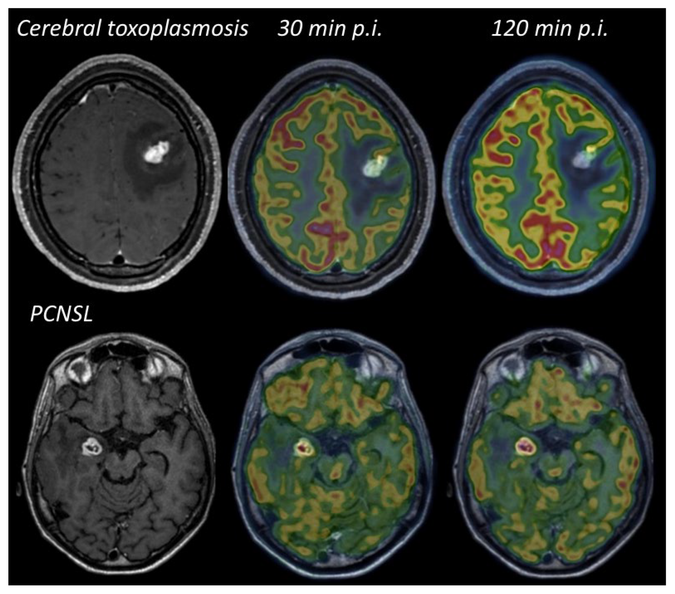 Cancers 14 04071 g005
