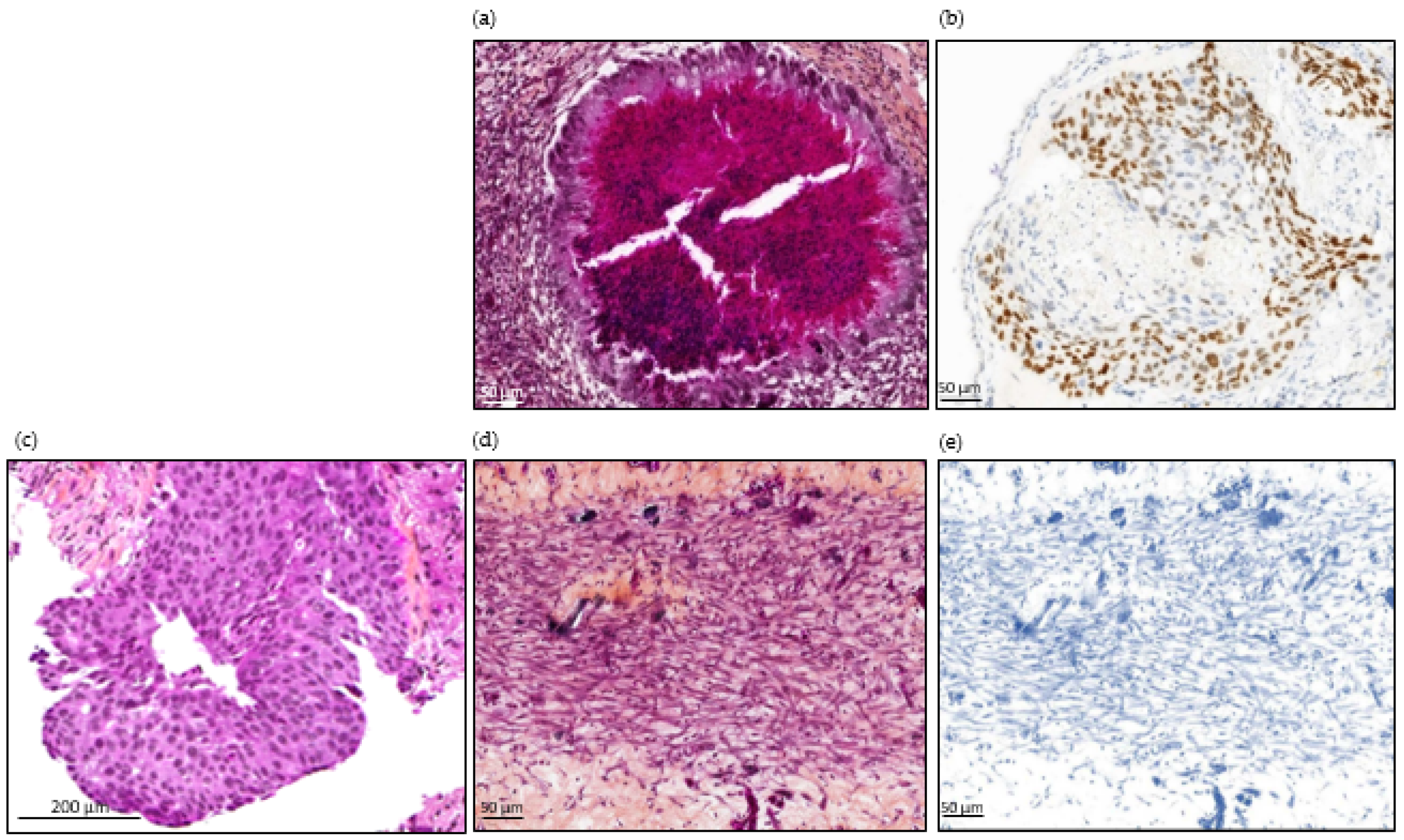 Cancers 14 04085 g005 550