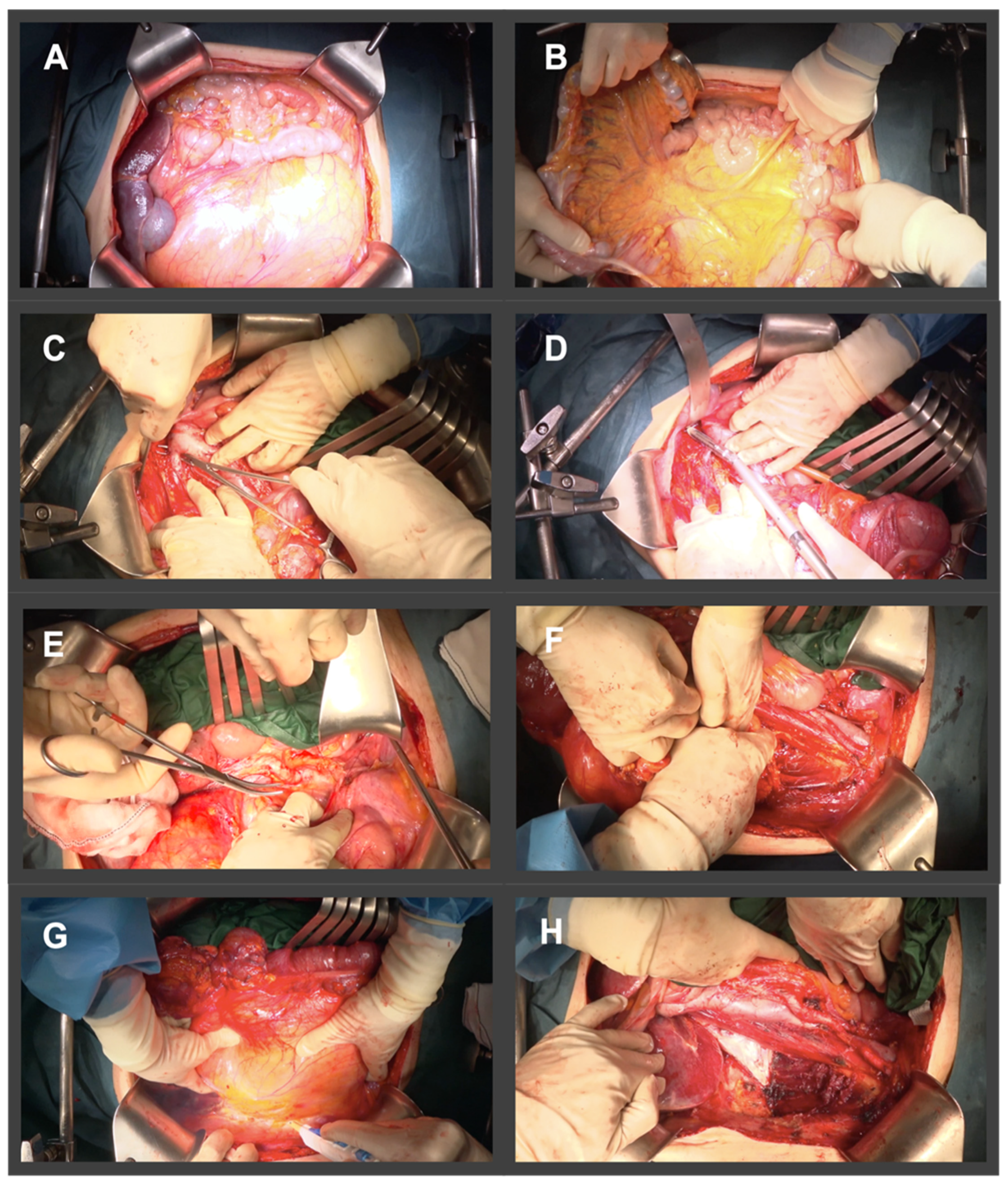 Cancers 14 04091 g002