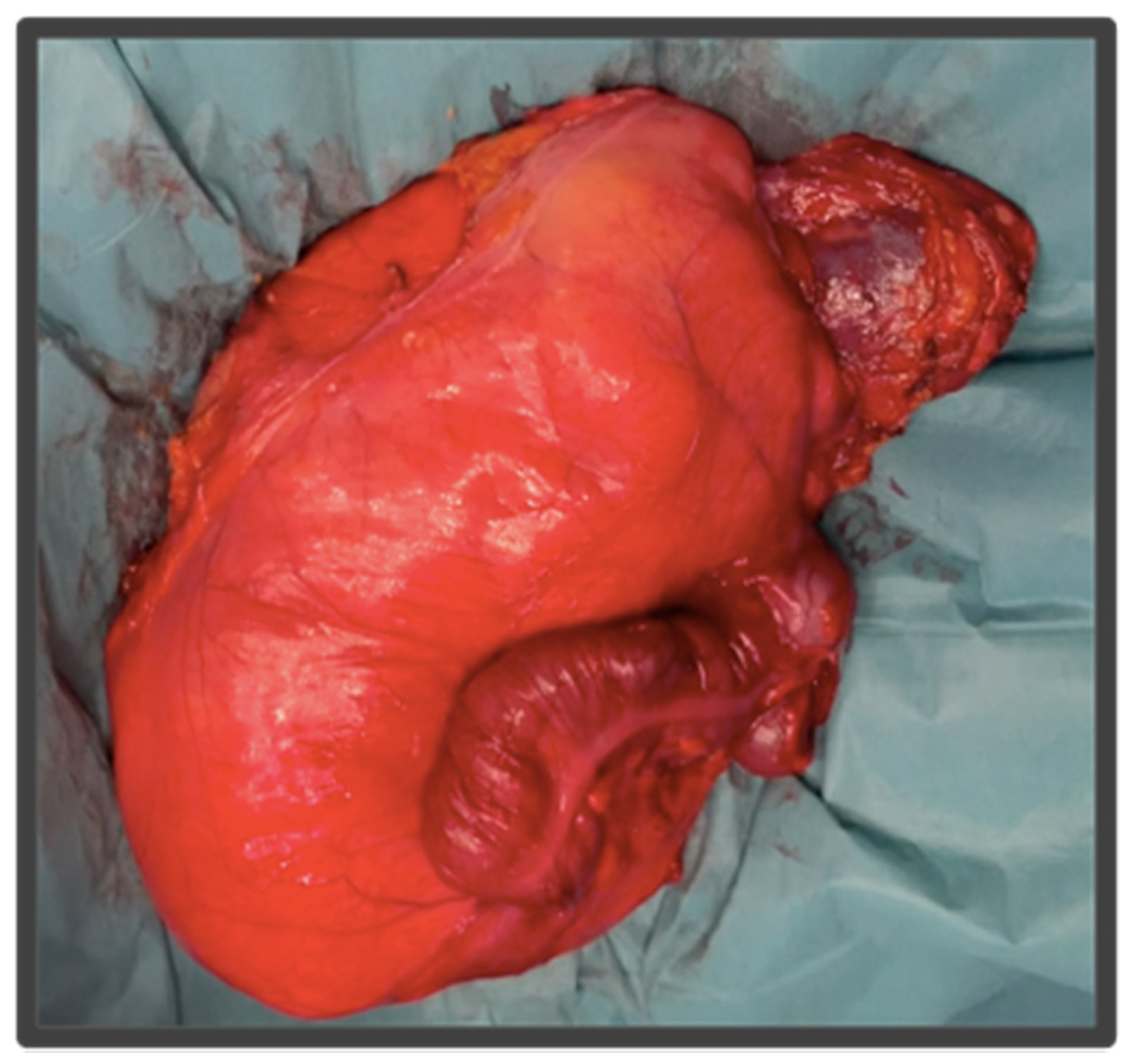 Cancers 14 04091 g003